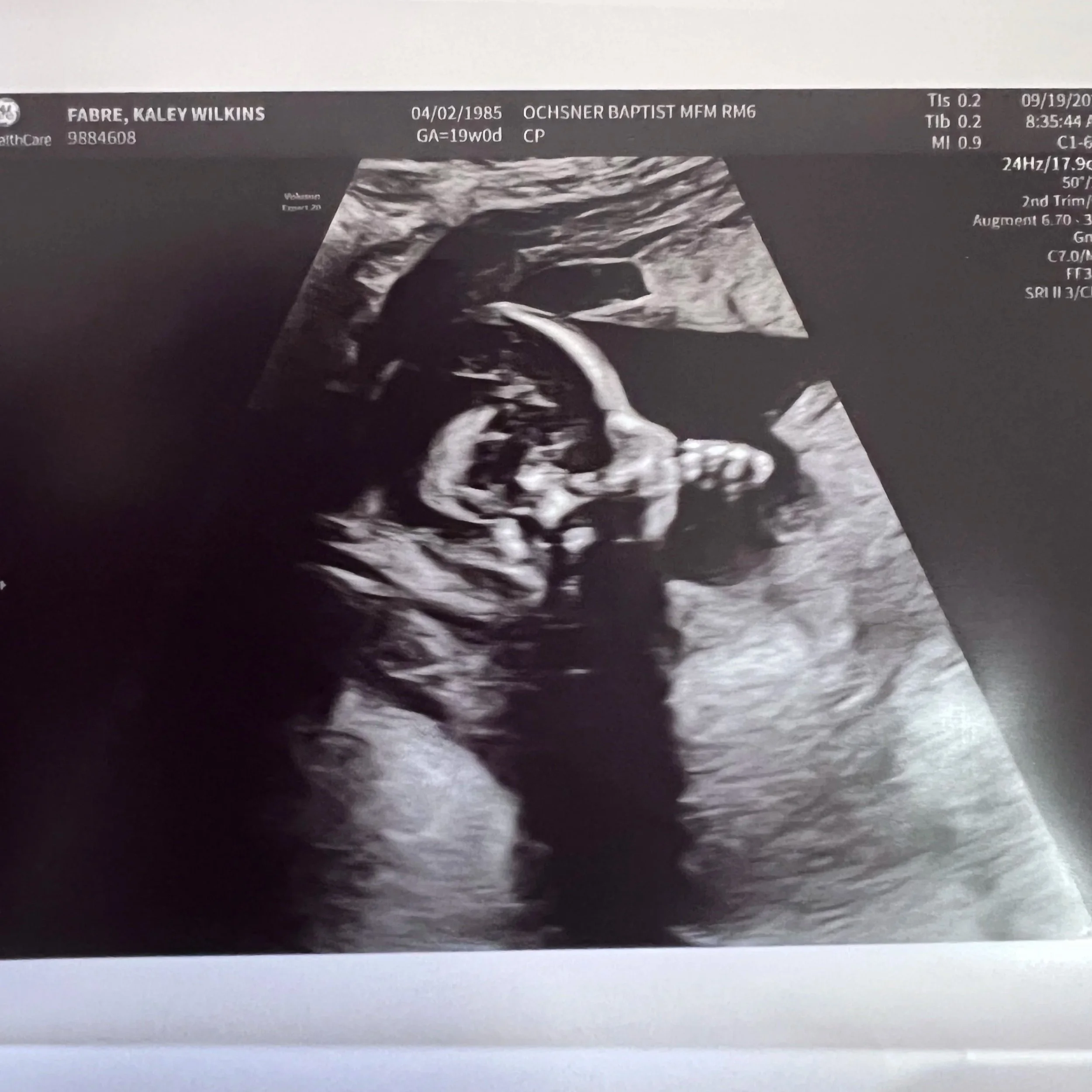 Baby Bean