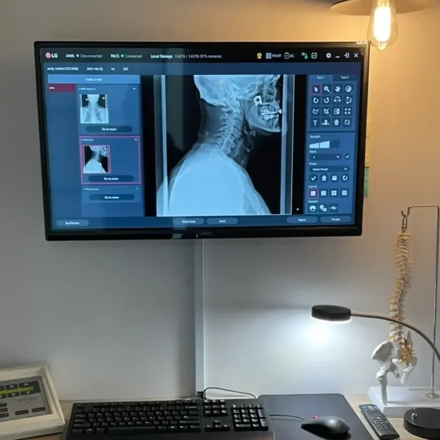 Digital cervical spine X-ray displayed at Fishman Chiropractic in Monroeville