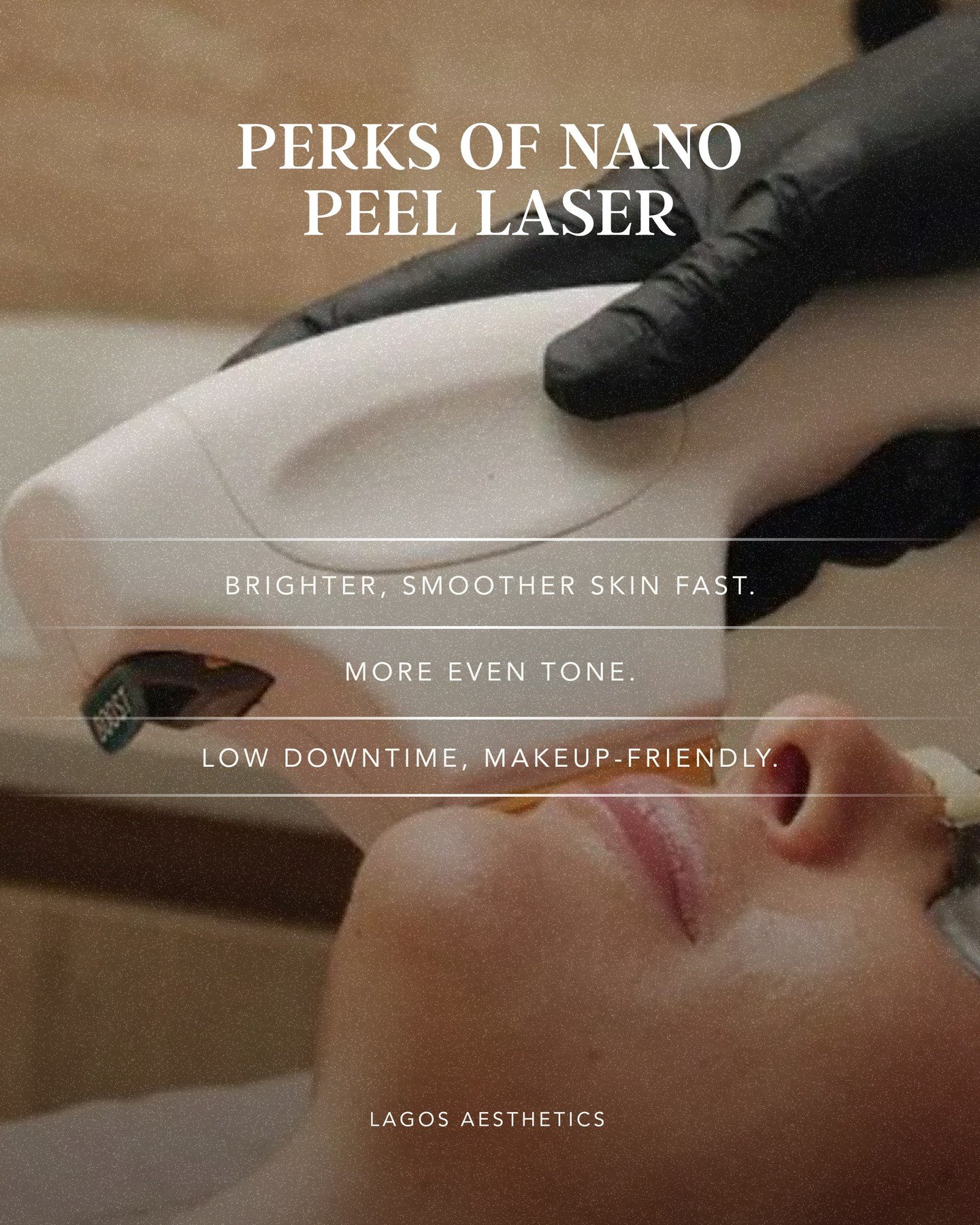 Quick results, low downtime.
The Nano Peel Laser is a go-to for refreshing skin without the recovery.