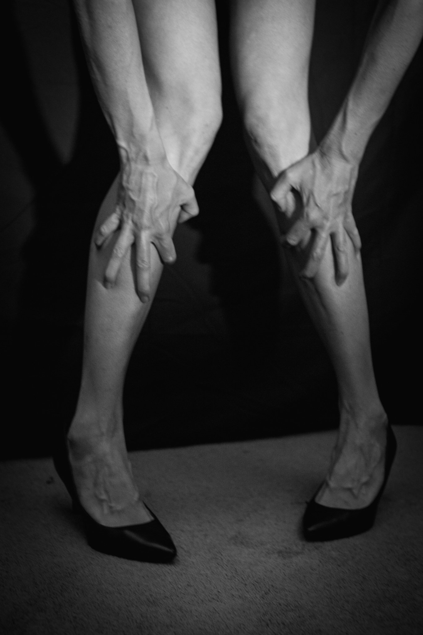 Black and white photo of a person's legs with visible veins, wearing black high heels, and holding their ankles.