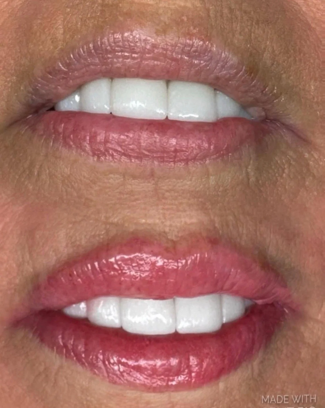 natural lip blushing