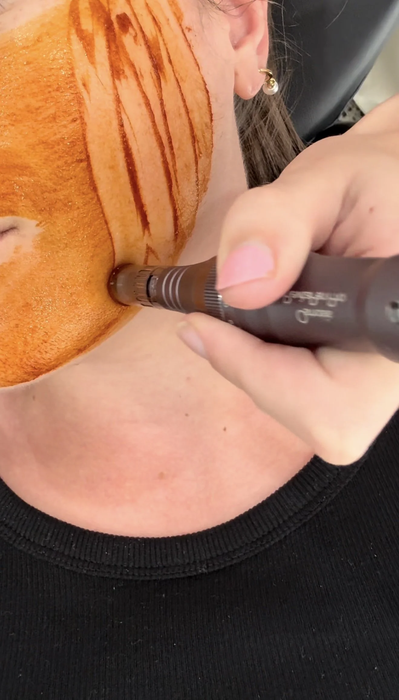 Your Skin’s Oil Flow