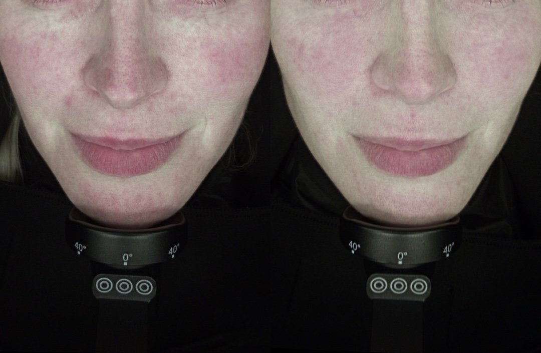 What Makes AnteAGE Different