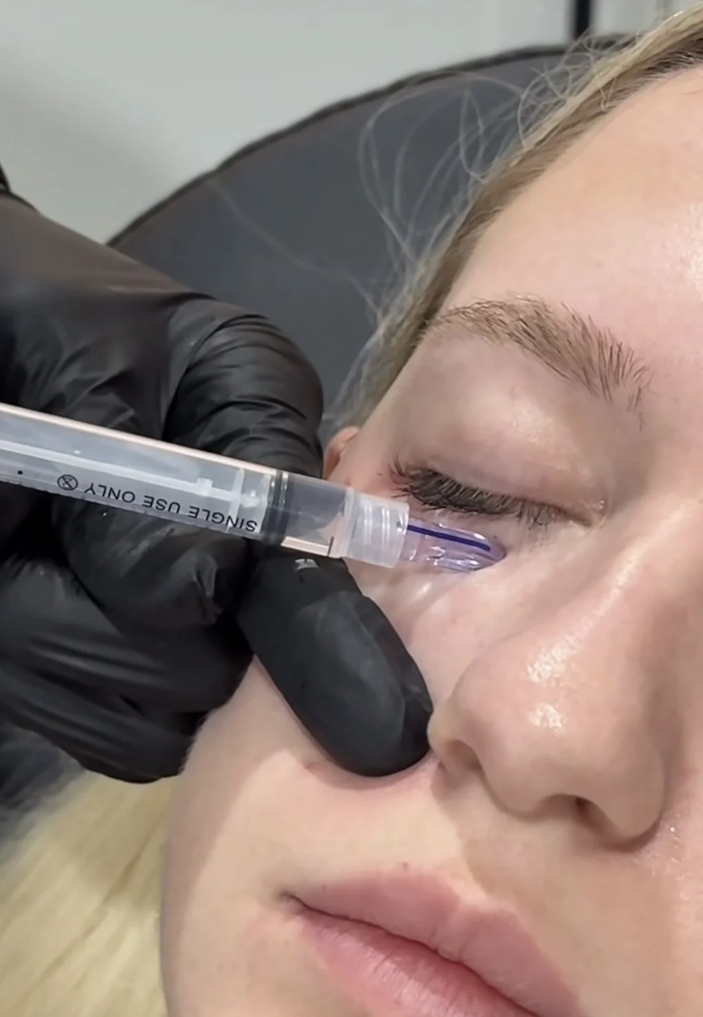 What Is PDRN? Understanding the Science Behind Skin Regeneration