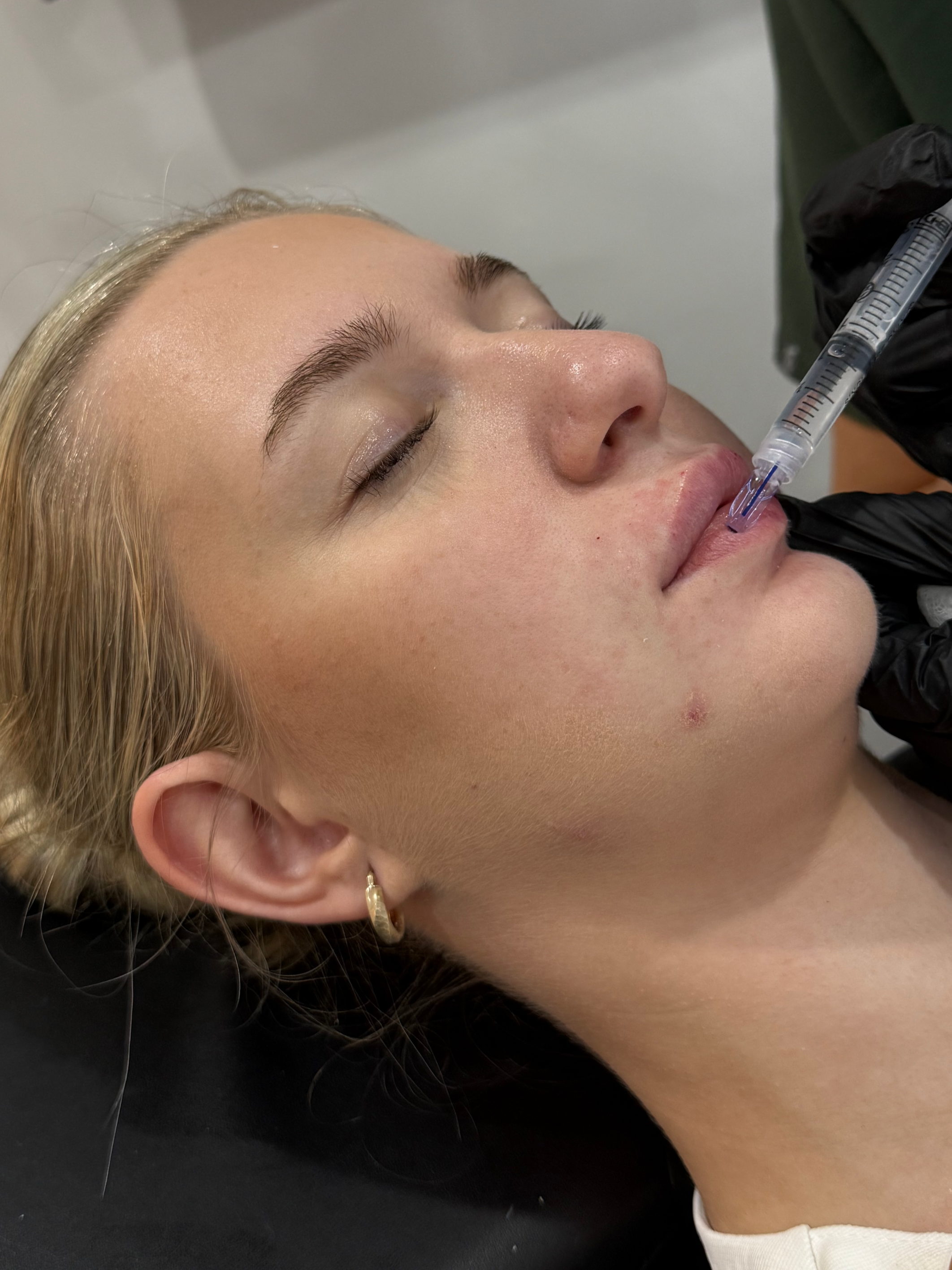 Lip Glossing: The Hydrating Lip Treatment
