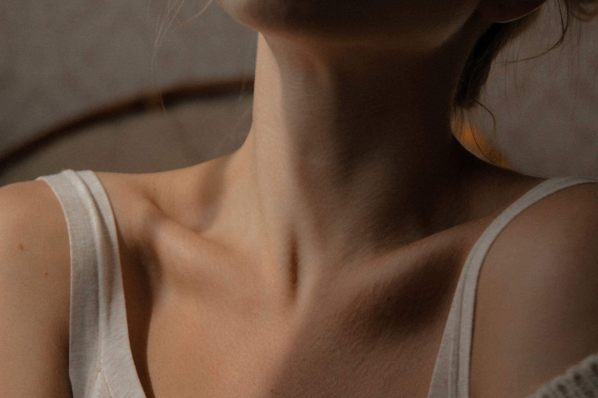 Chondrolaryngoplasty (Tracheal Shave)
