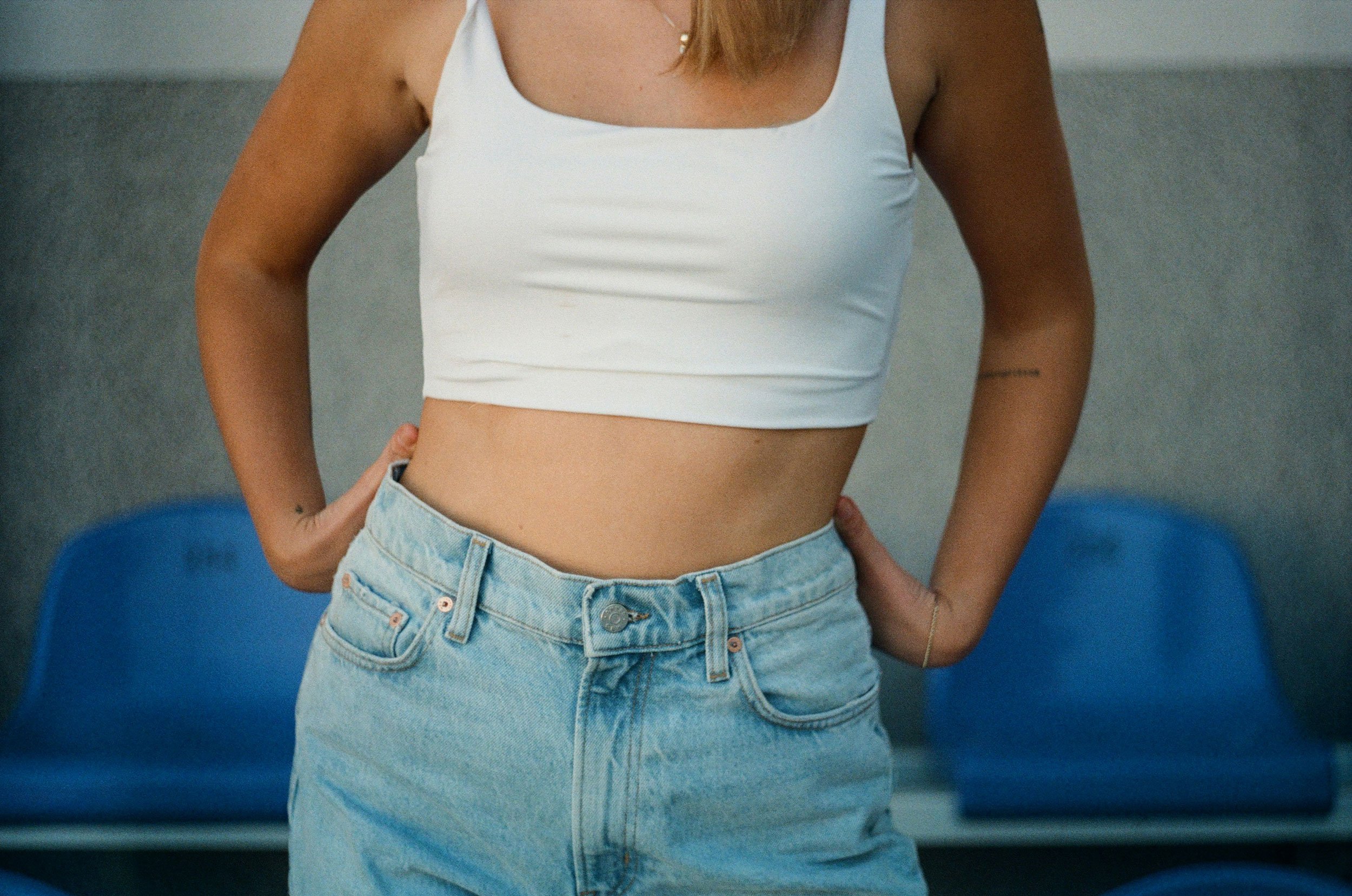 Abdominoplasty (Tummy Tuck)