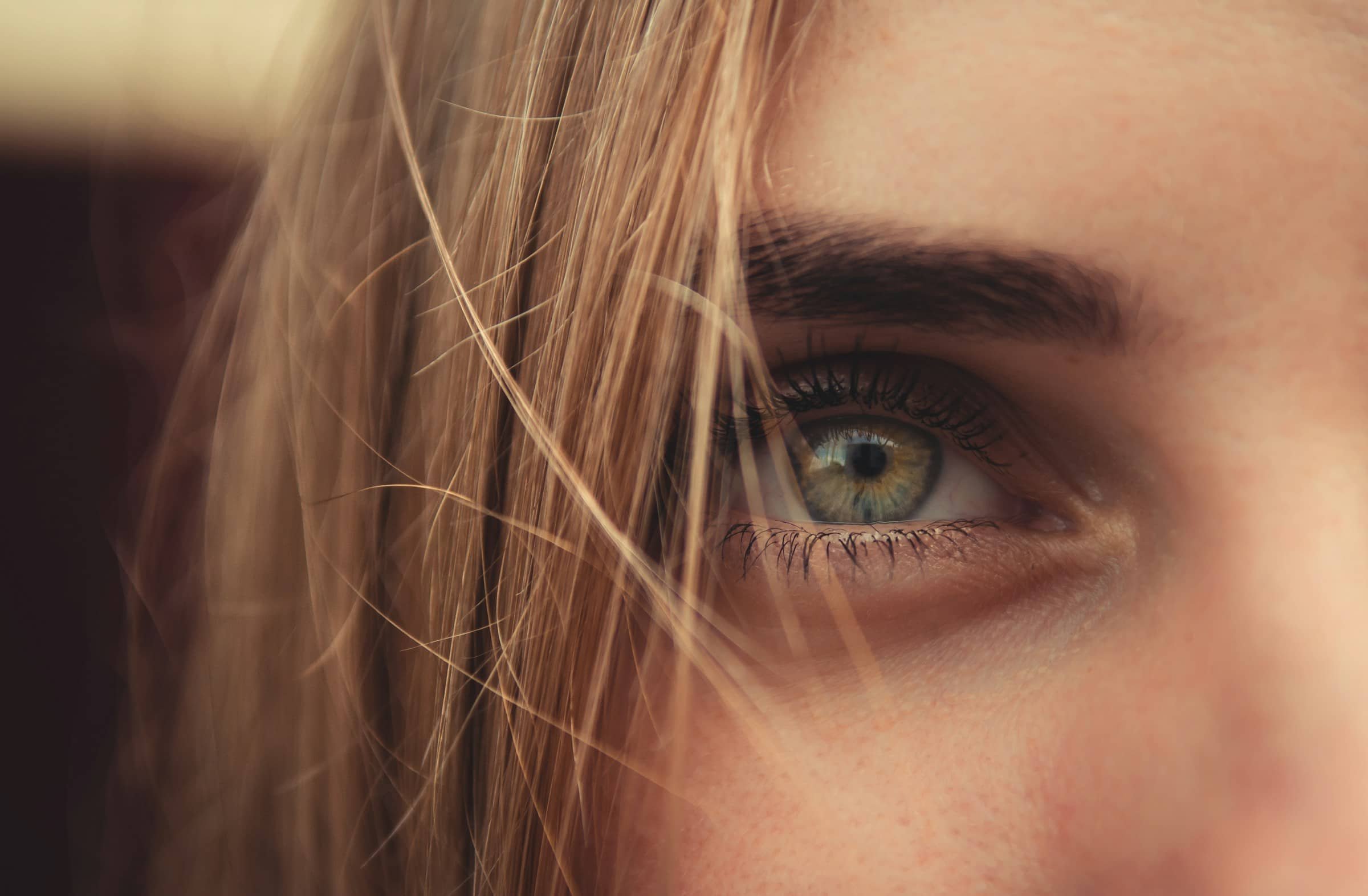 Upper Lid Blepharoplasty