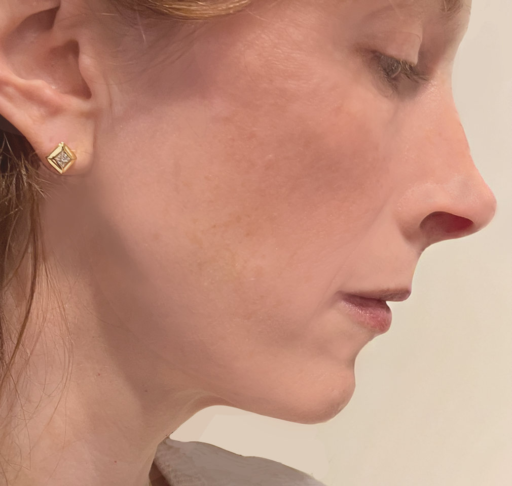 Erring Closeup.png