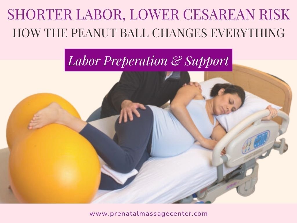 Shorter Labor, Lower Cesarean Risk with Peanut Ball