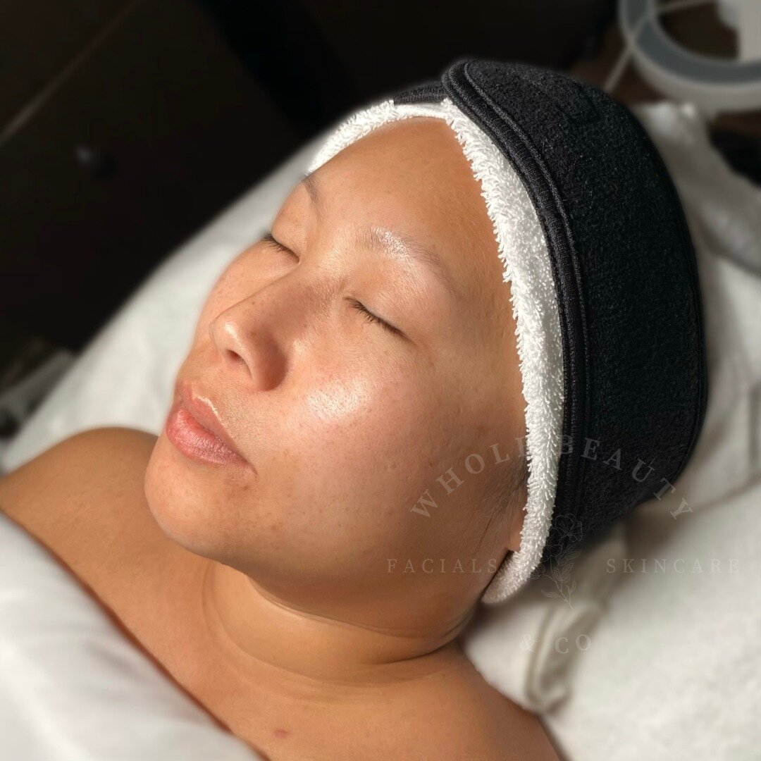 Can you believe we didn't do any major exfoliation in this 60-minute Glass Skin? Instead, we double masked with two different treatment cream masks that focused on repairing, hydration and moisture retention. Most times, you'll need professional exfo