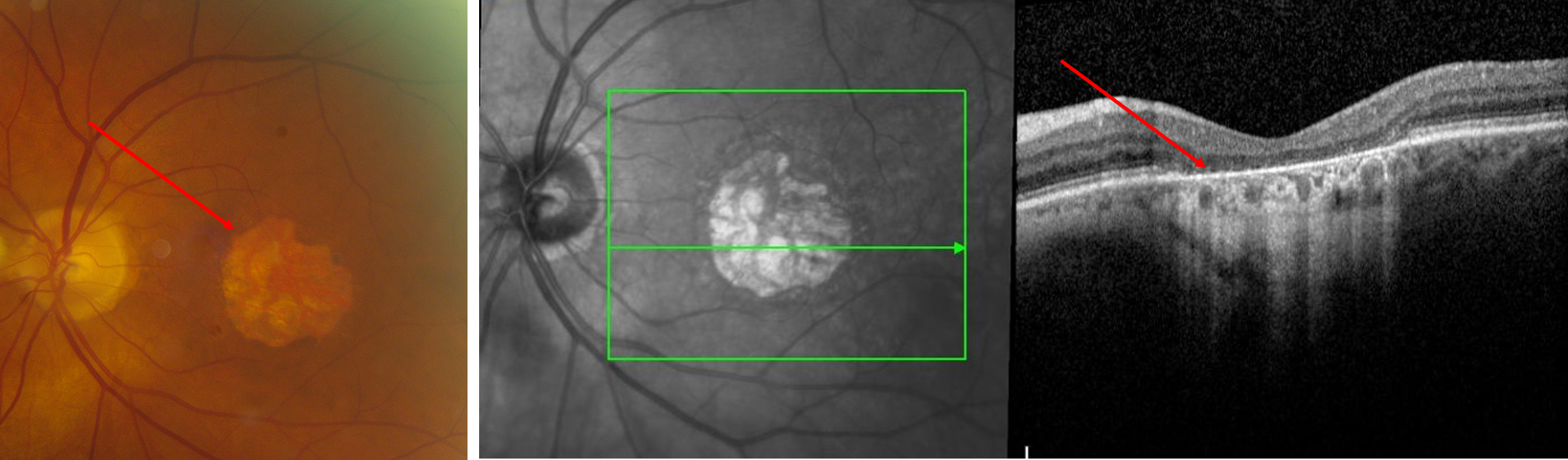 Combined+image+of+dry+amd+w+GA