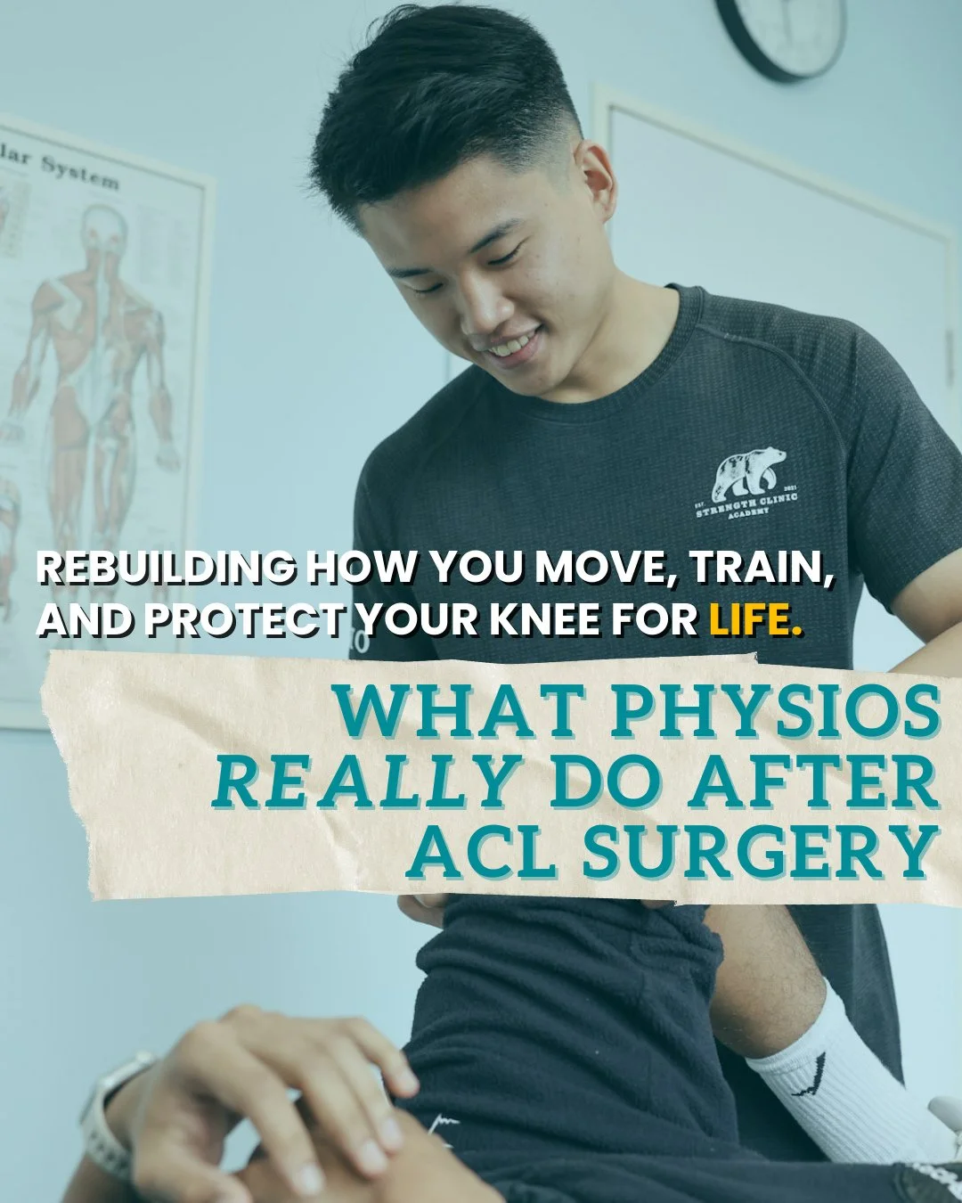 💪 Curious about what physiotherapists do after ACL surgery? It's more than just rehab it's a science-backed roadmap to get you back stronger than before.⁠
⁠
From early recovery to sport-specific performance, physiotherapists guide you through 5 key 