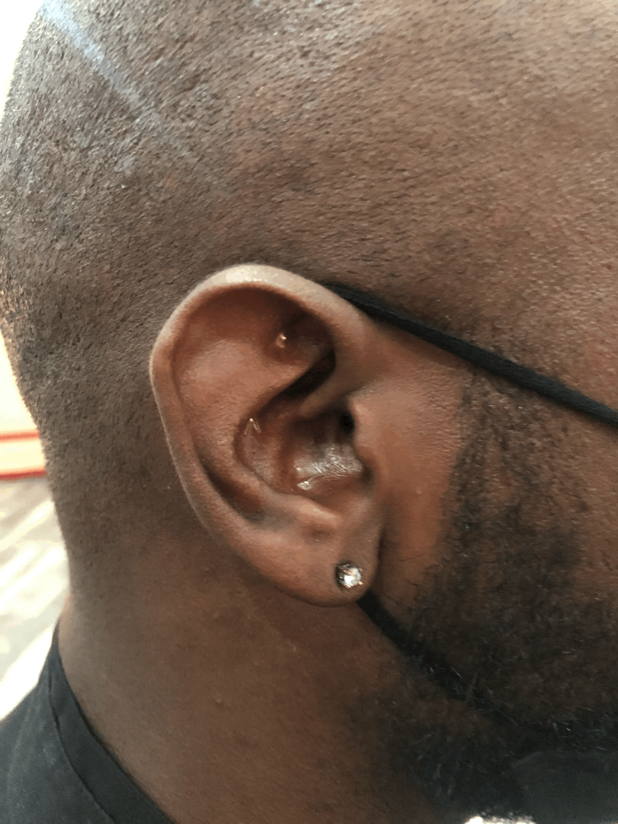 FREE Ear Seeds