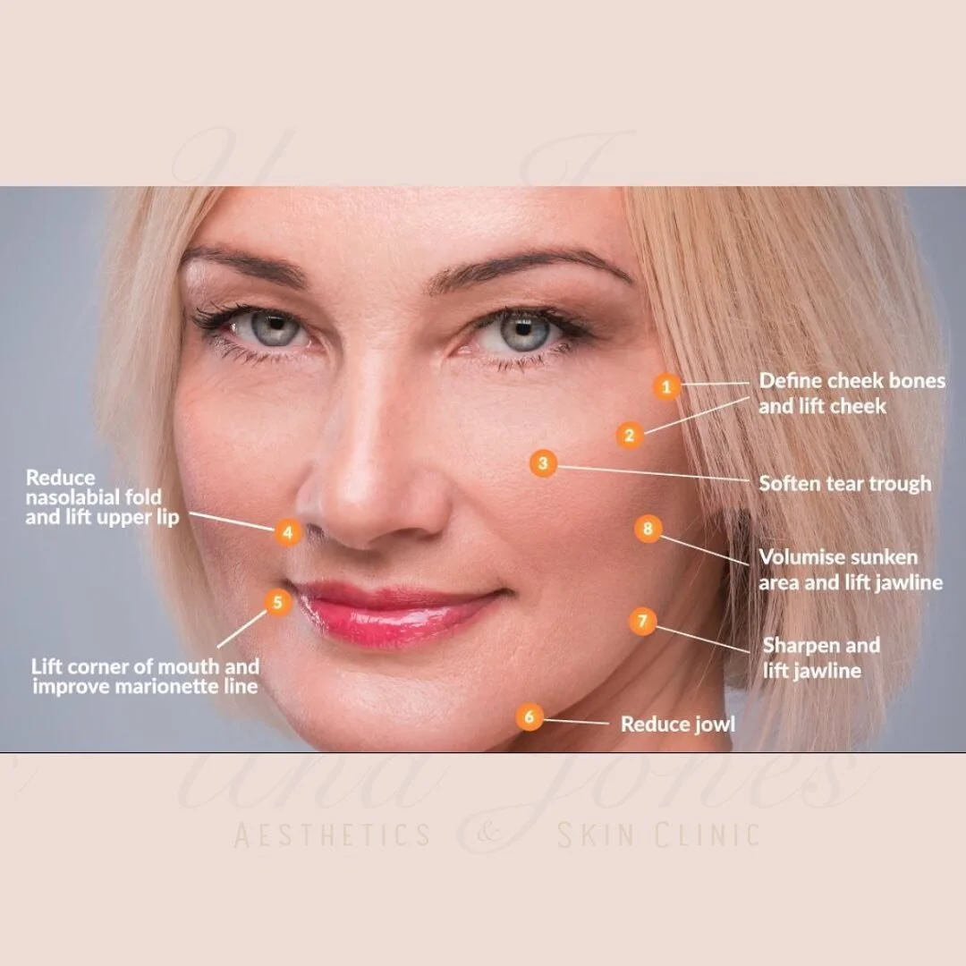 NEW TREATMENT ALERT-
Liquid face lift!!

One of the biggest signs of ageing in our faces is loss of volume, especially around the cheek and jowl areas. This loss of volume can lead to sagging of the skin, accelerating the development of the nasolabia