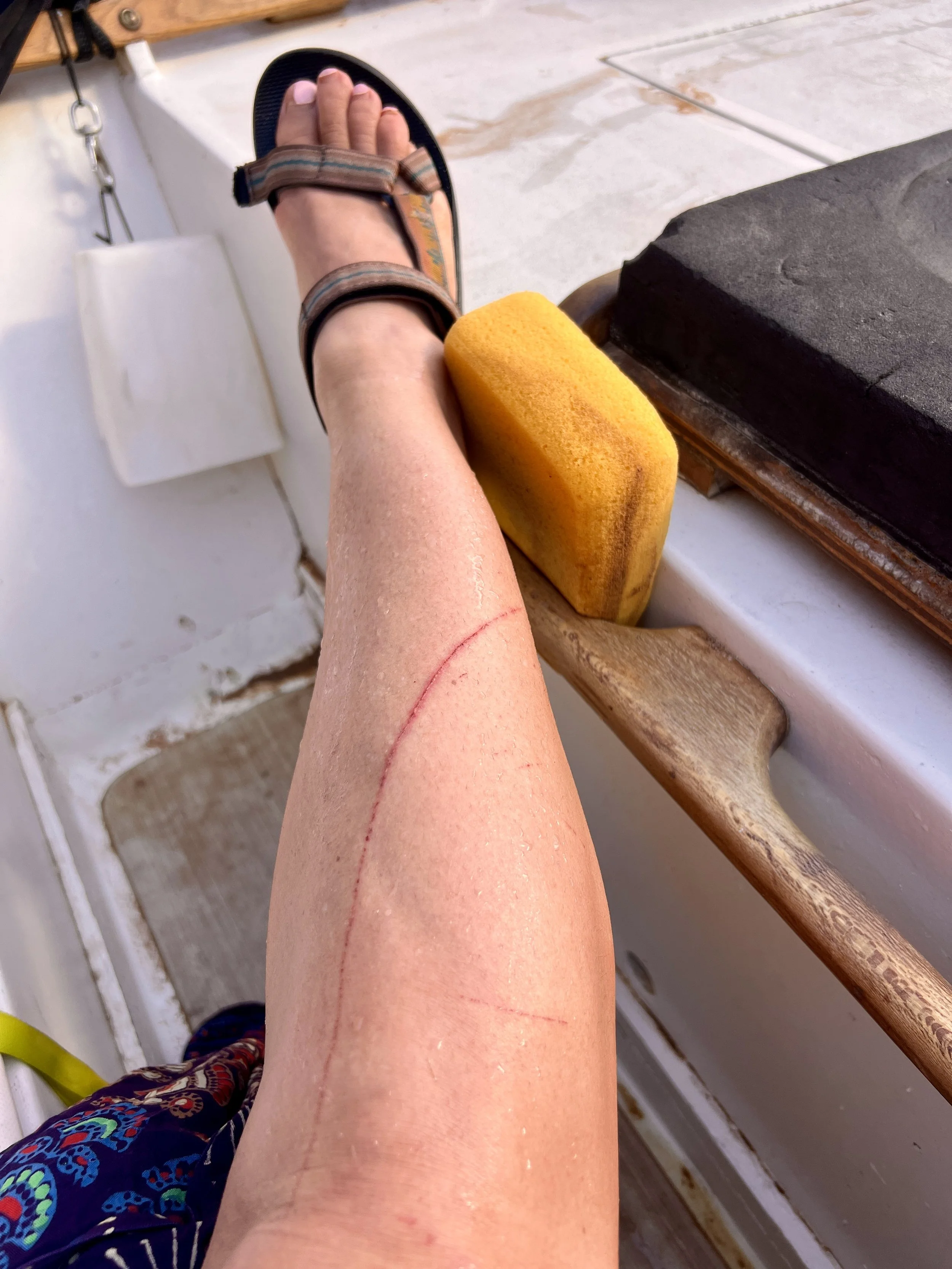My first wound