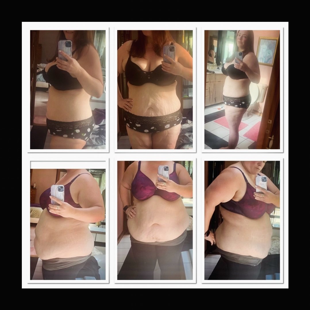 Jackie started her weight loss journey in August, 2023 by joining my medical weight loss program.  Adding semaglutide to a healthy eating plan and exercise routine  helped boost her weight loss and increased her motivation even more.

Since then, she