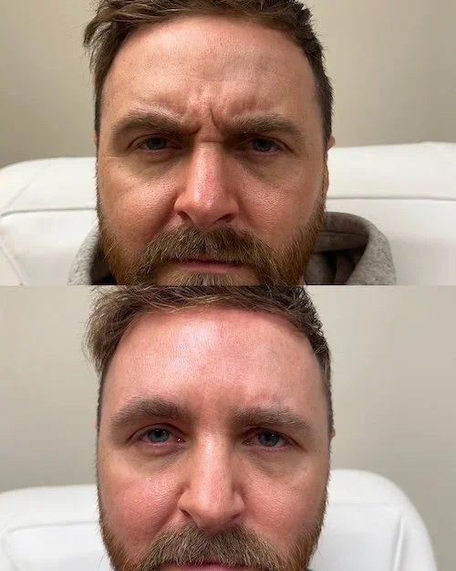 man-botox-treatments-north-shore-ma.JPG