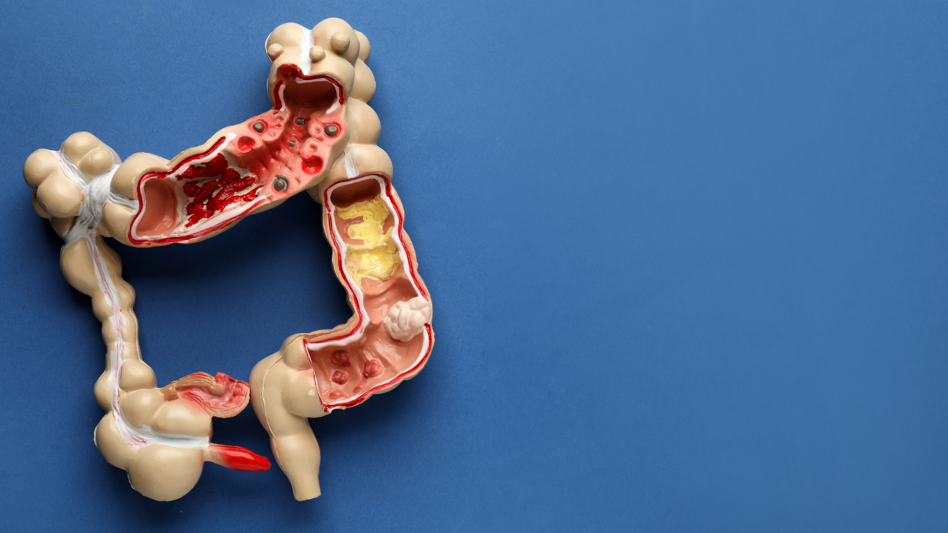 Anatomy of the Colon and Rectum