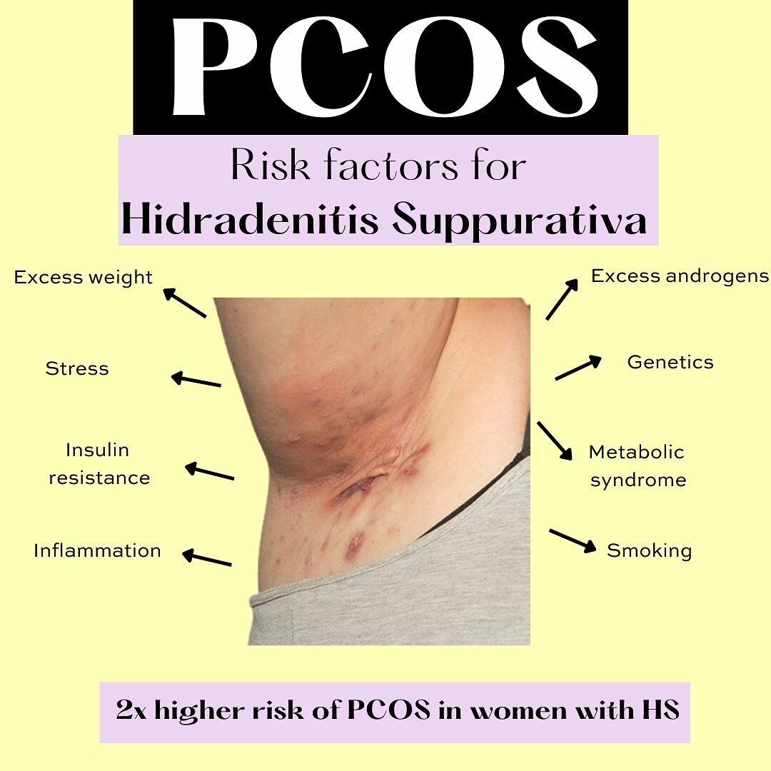 Hidradenitis suppurativa -  is a chronic inflammatory skin condition  that causes painful pus-filled nodules and abscesses to form around the hair follicles. 

HS lesions typically occur in the armpits, groin, abdominal folds, and breast areas. 

