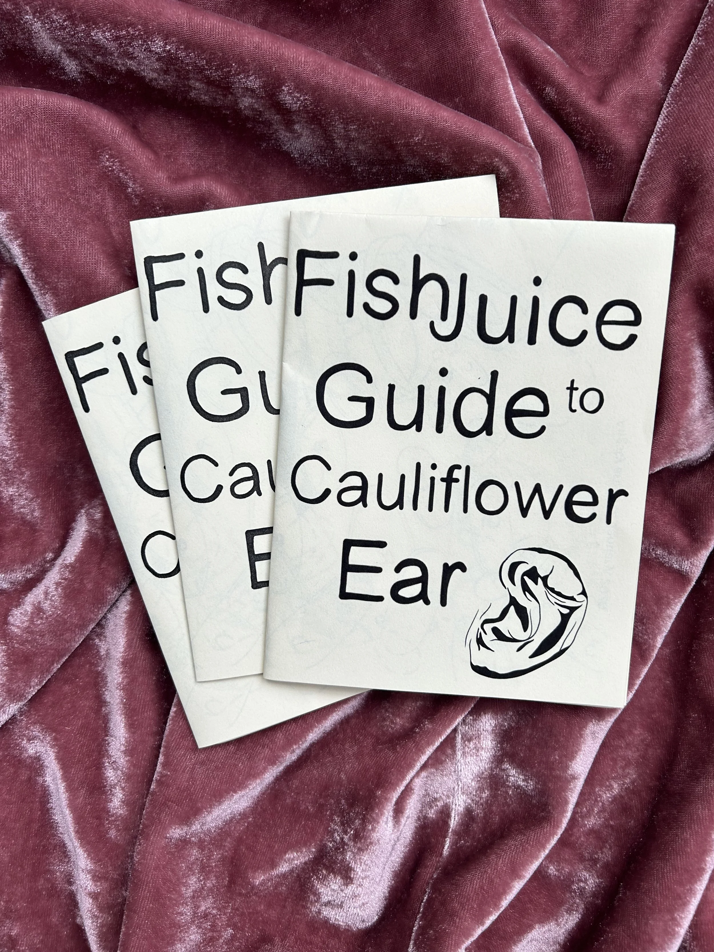 Guide_to_cauliflower_ear.jpg