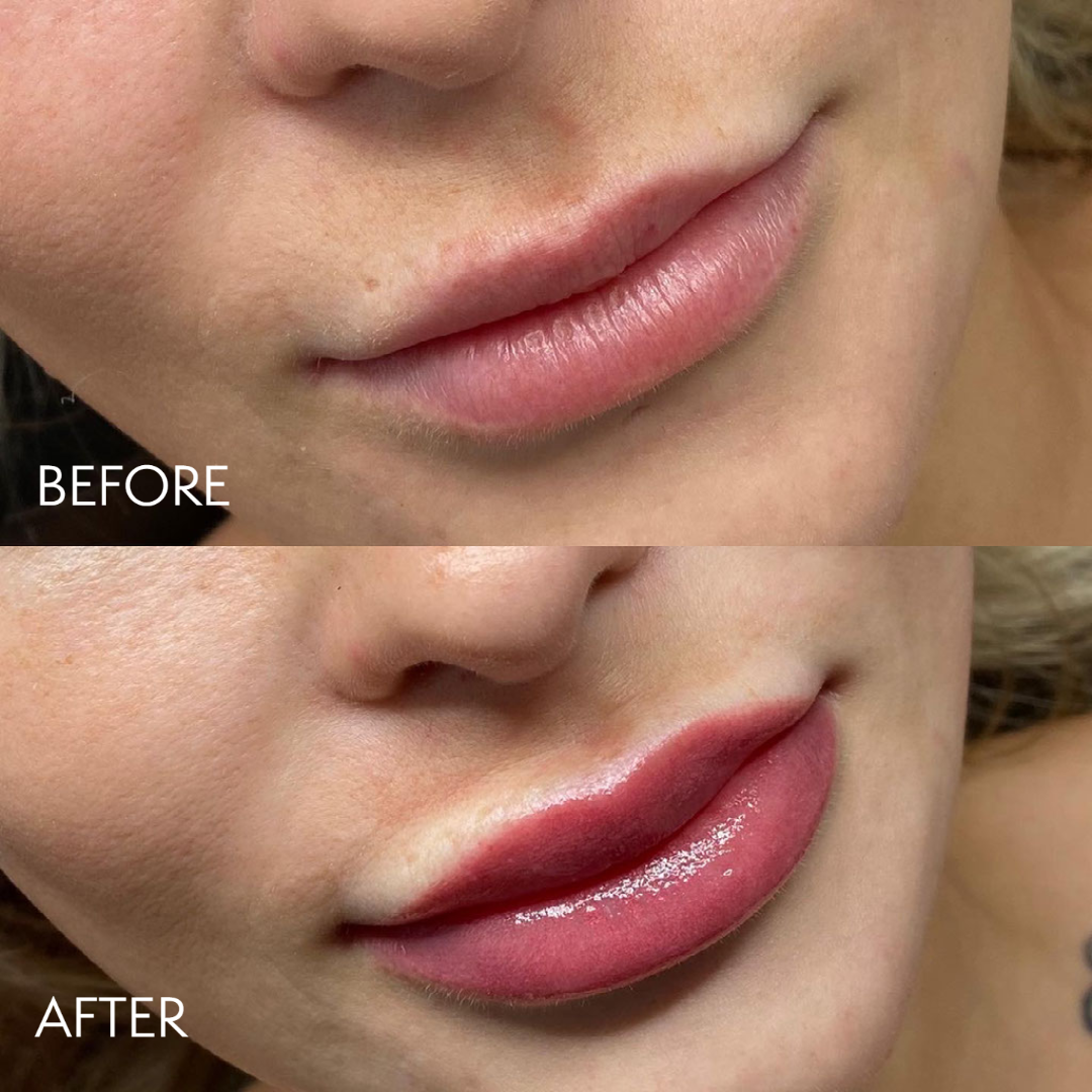 My project-1 (8).png