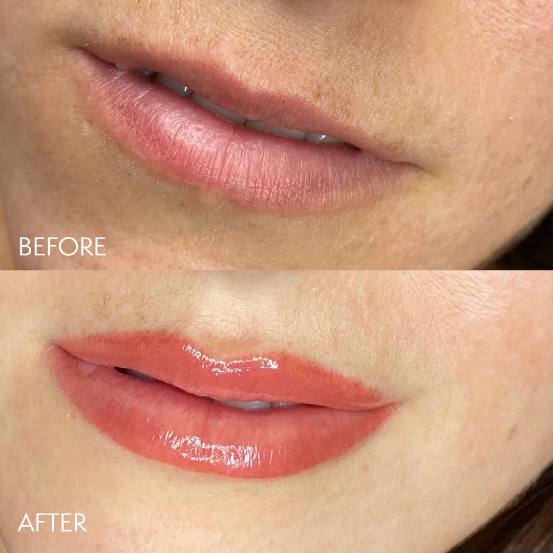 My project-1 (7).png