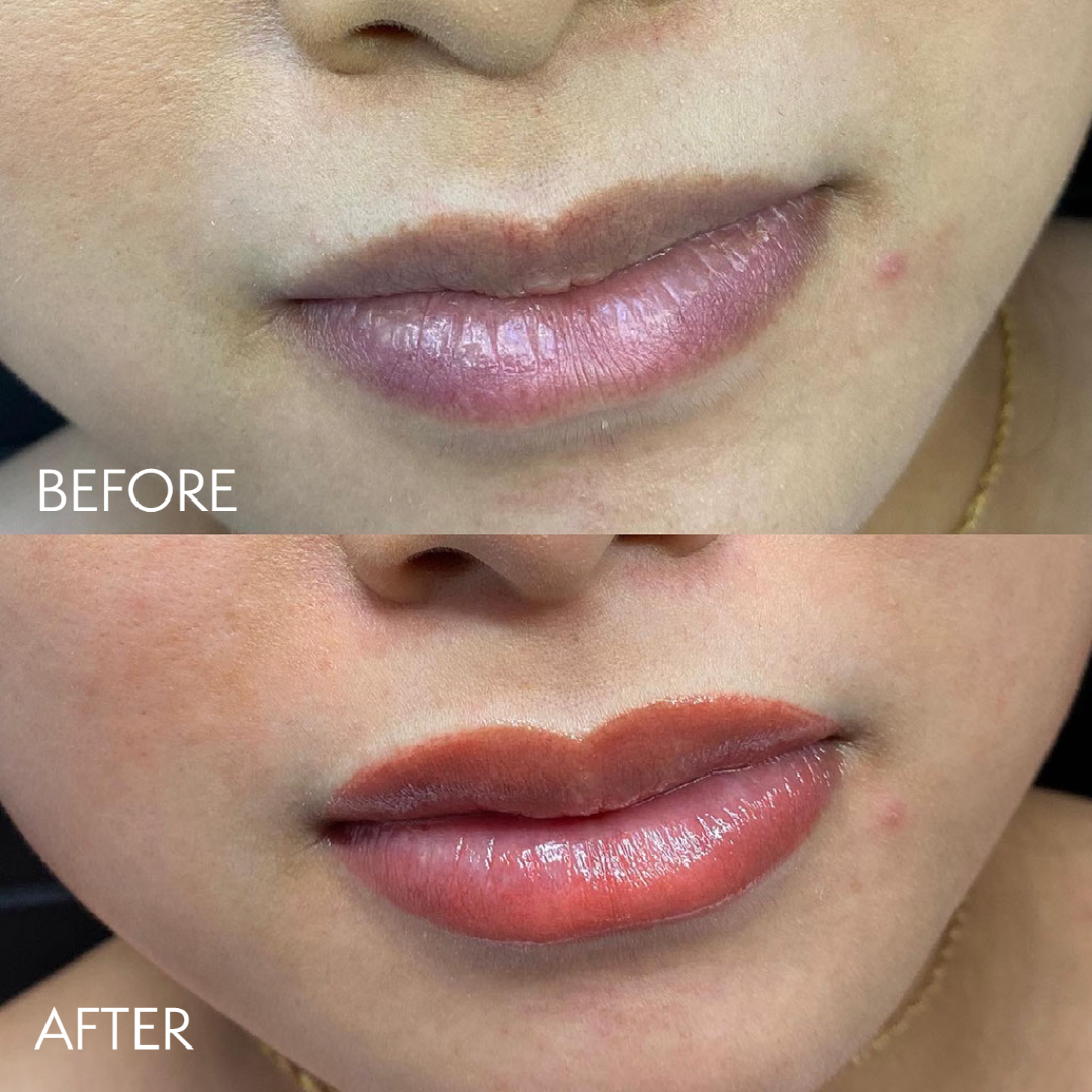 My project-1 (6).png