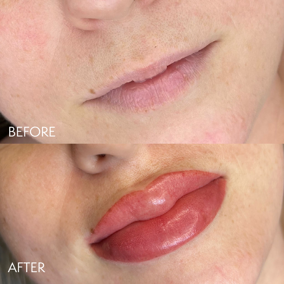 My project-1 (4).png