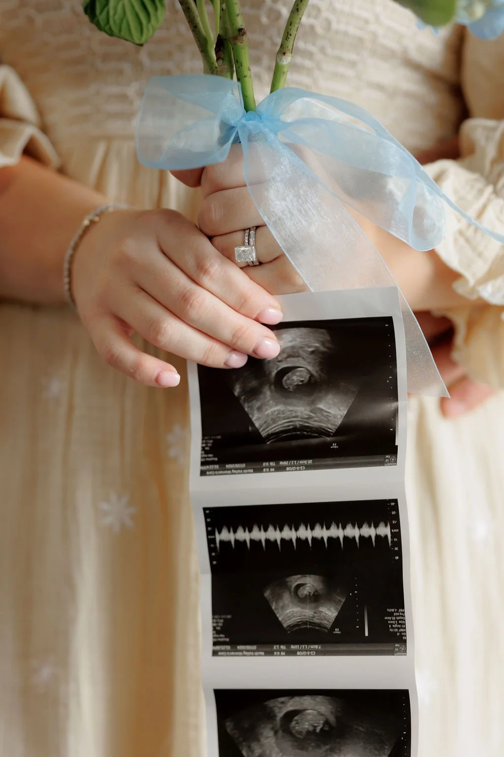 Pregnancy announcement photos