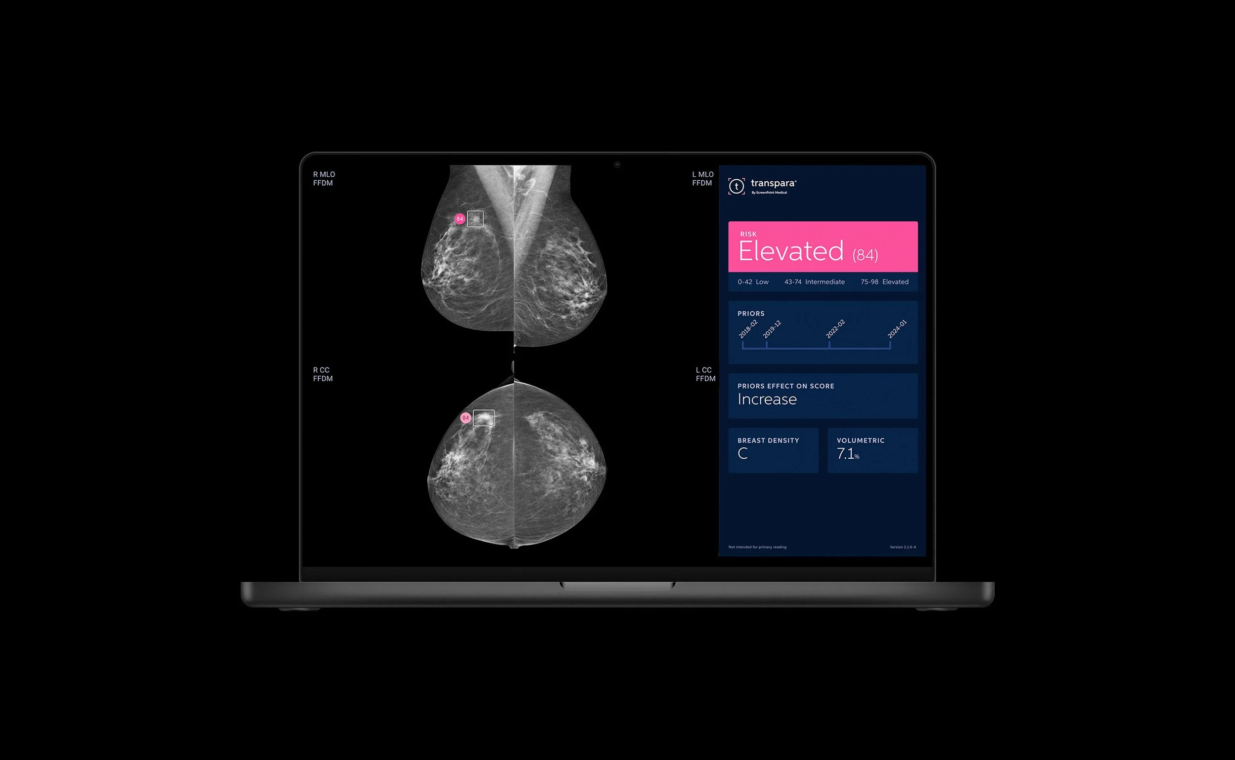 ScreenPoint Medical Report