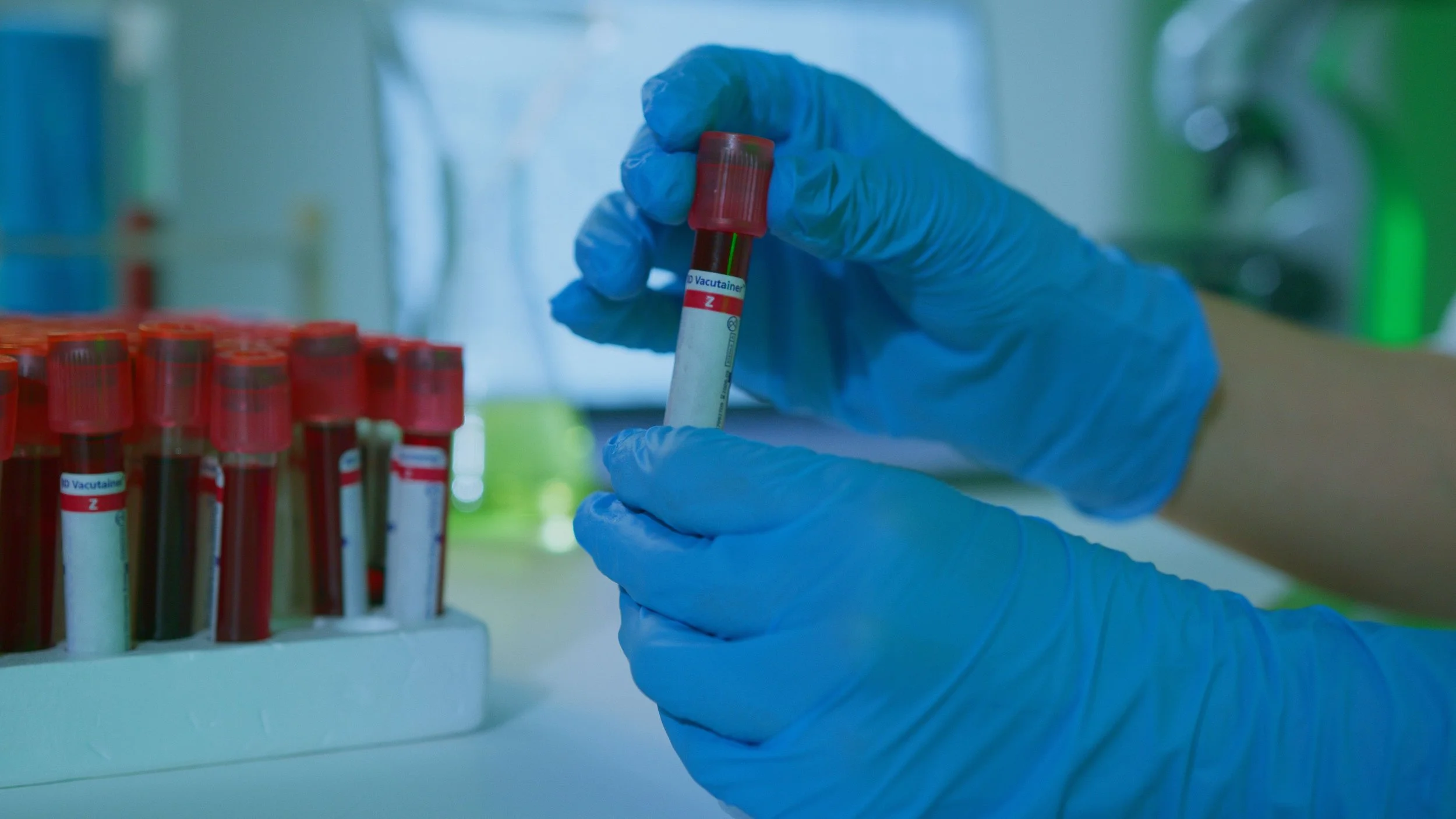 The Lab Isn’t Broken, The Handover Is: Rethinking Pre-Analytical Diagnostics in the NHS