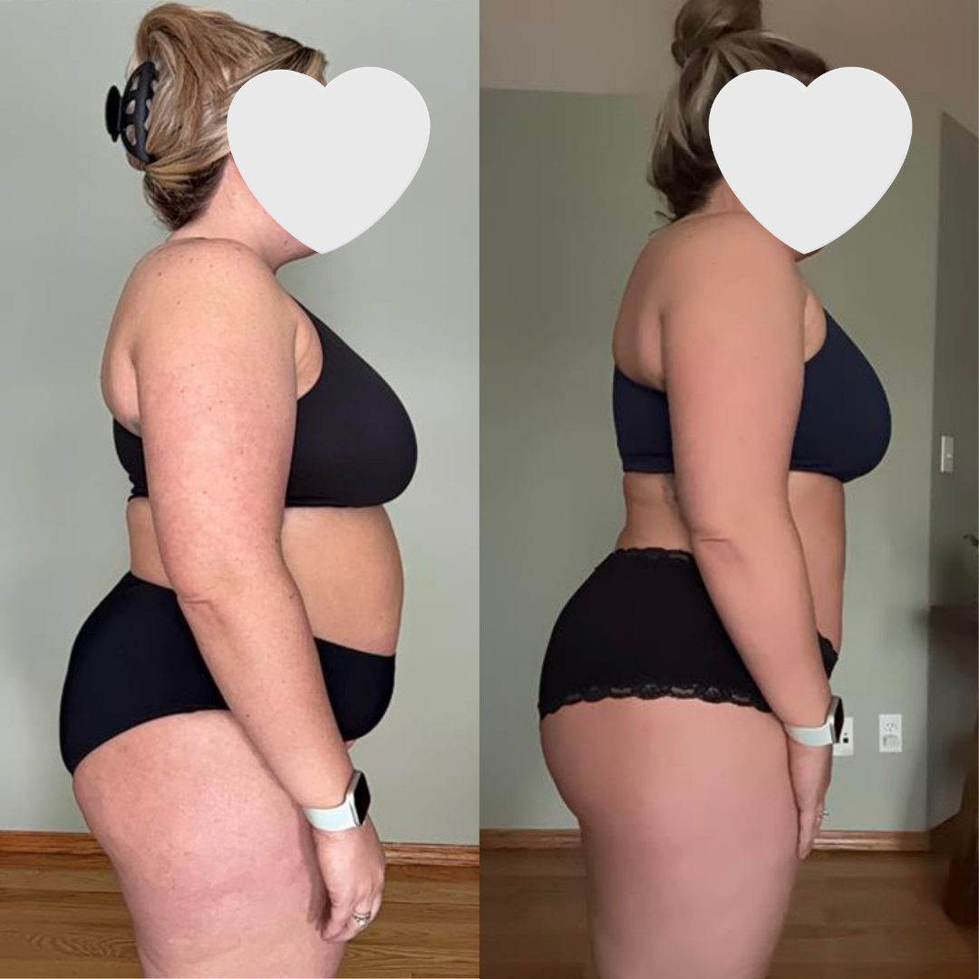 Before and Afters 2.PNG