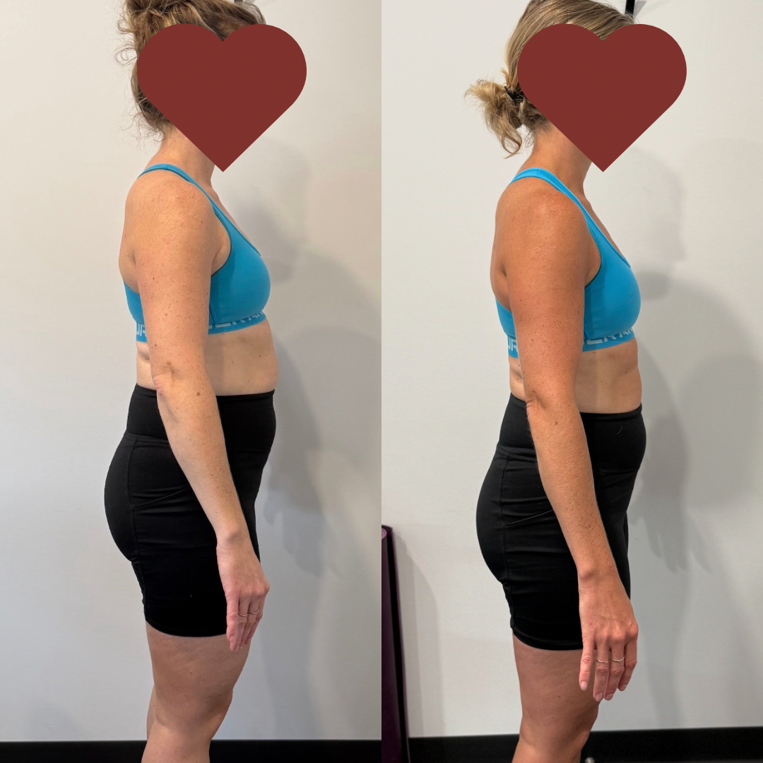 Before and Afters 3.PNG