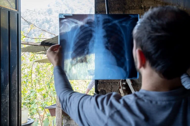 David holding an x-ray against the light