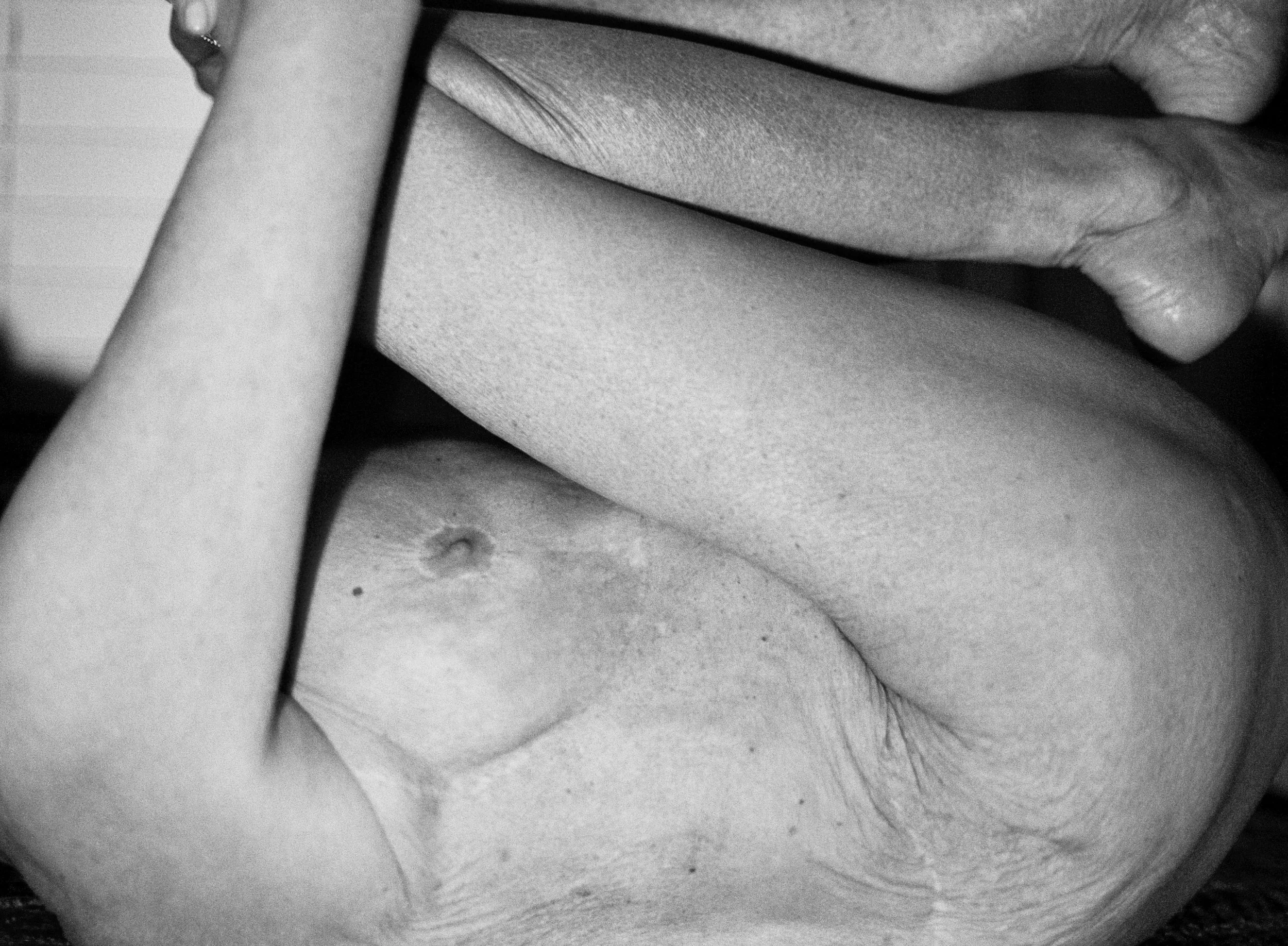 BODY000 series