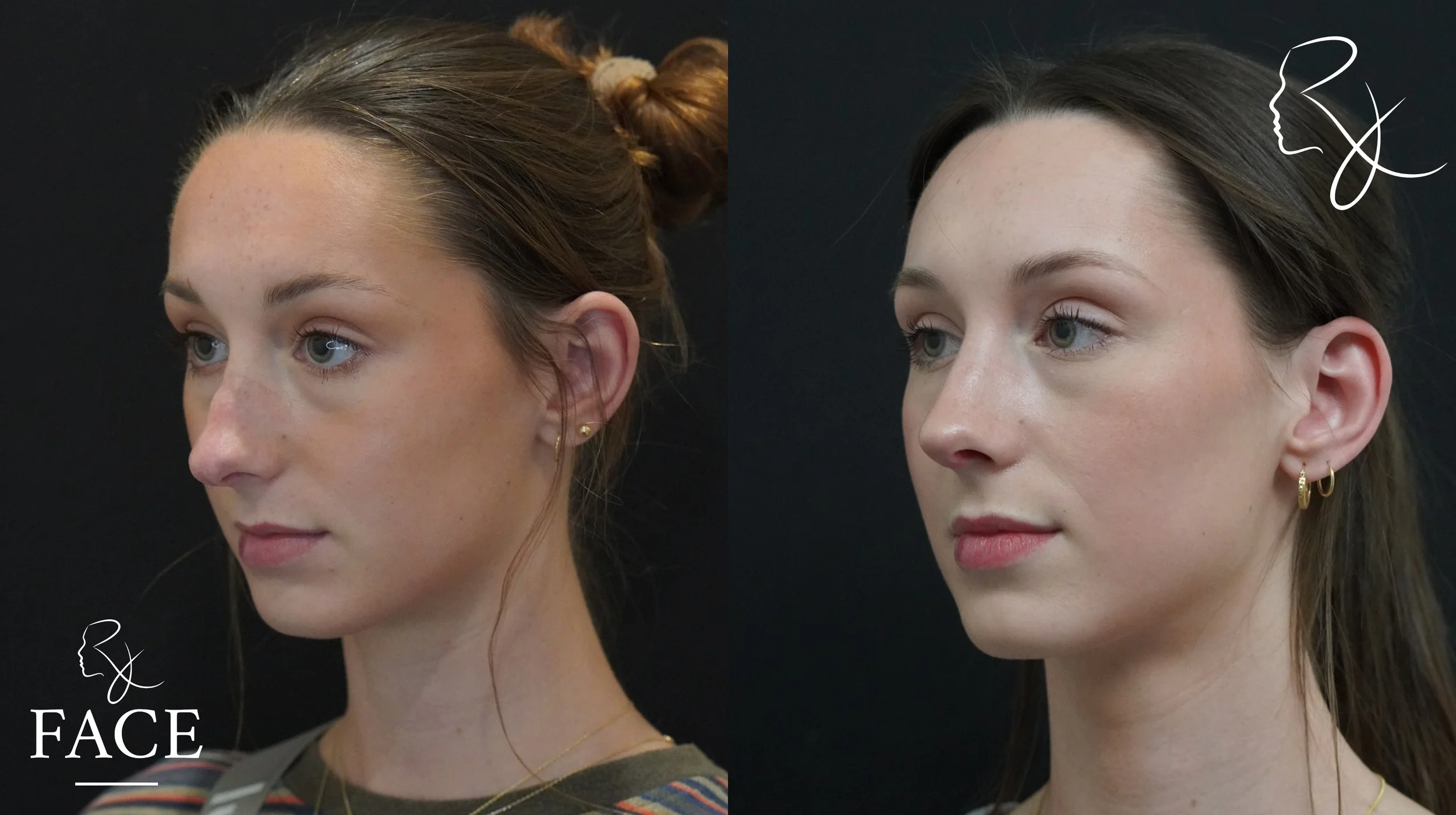 The outcome or results depicted are not 
guaranteed and may vary between patients.