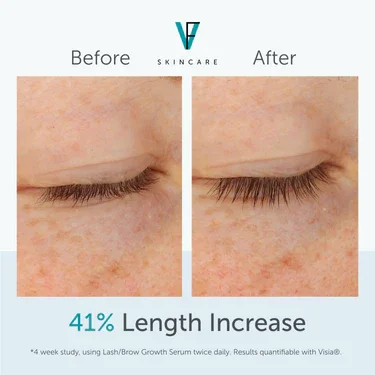 lash_brow_growth_serum_results_eyelash_length_375x375_crop_center.webp