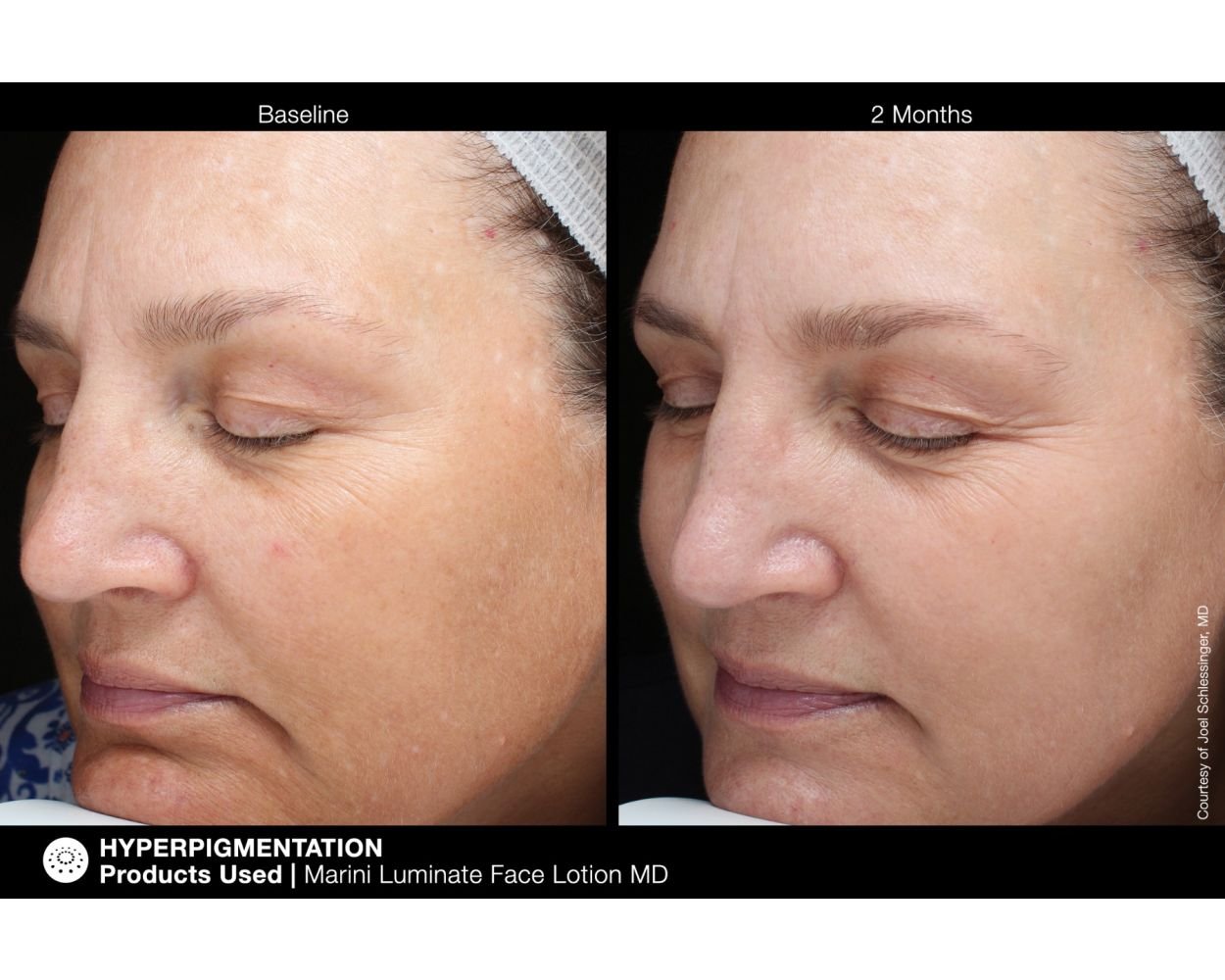 marini.luminate.facelotionmd_6_hd.jpeg