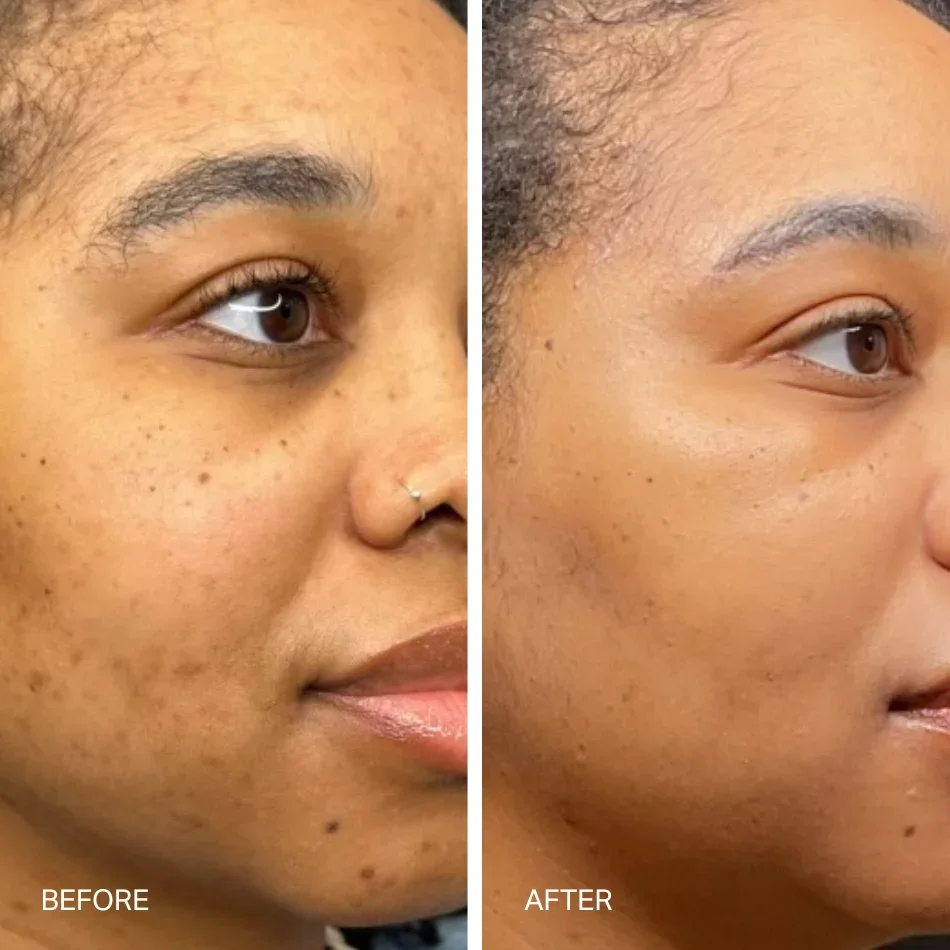 lenox-sixteenth-laser-serum-results-1.webp