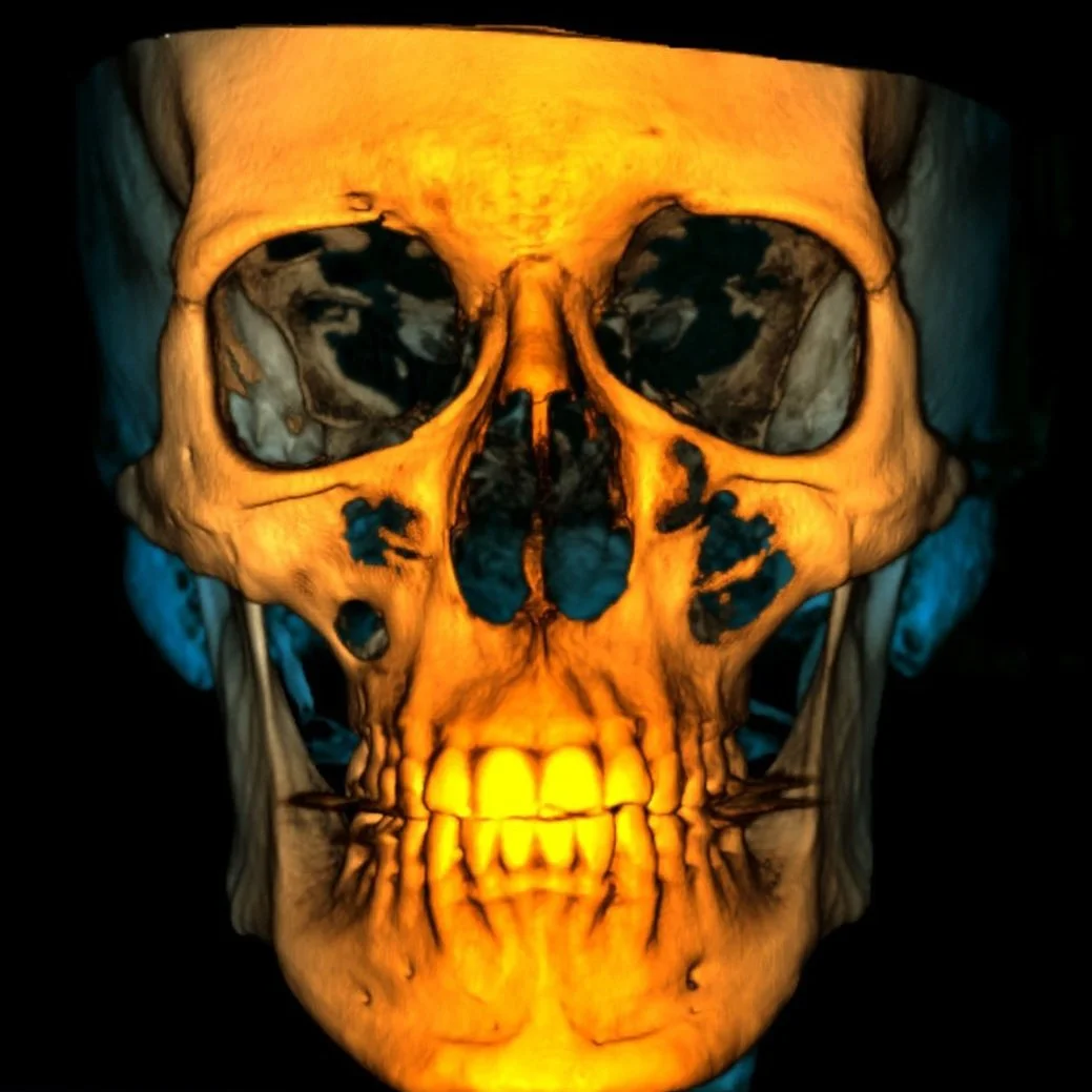 Estudios 3D - Cone Beam (CBCT)