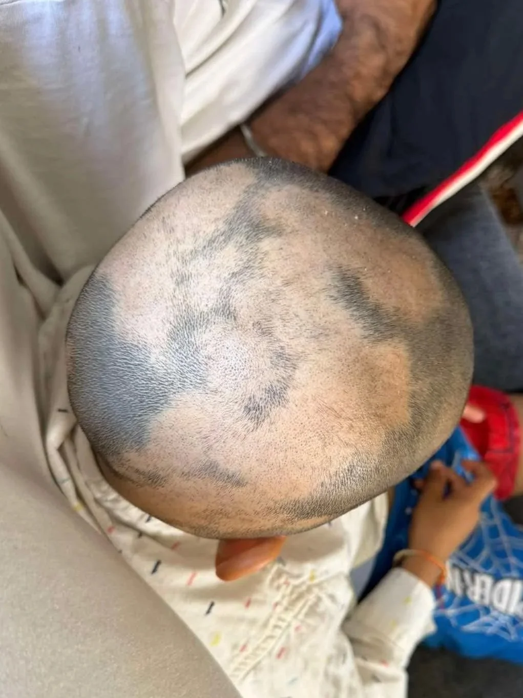 Close-up of a child's head showing a shaved hairstyle with patterns.