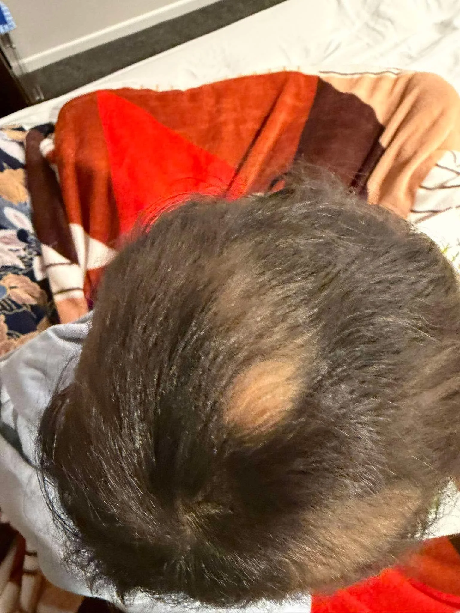Close-up of a person's dark hair, showing the crown and top of their head. The individual appears to have a natural hairstyle with some wave or curl pattern.