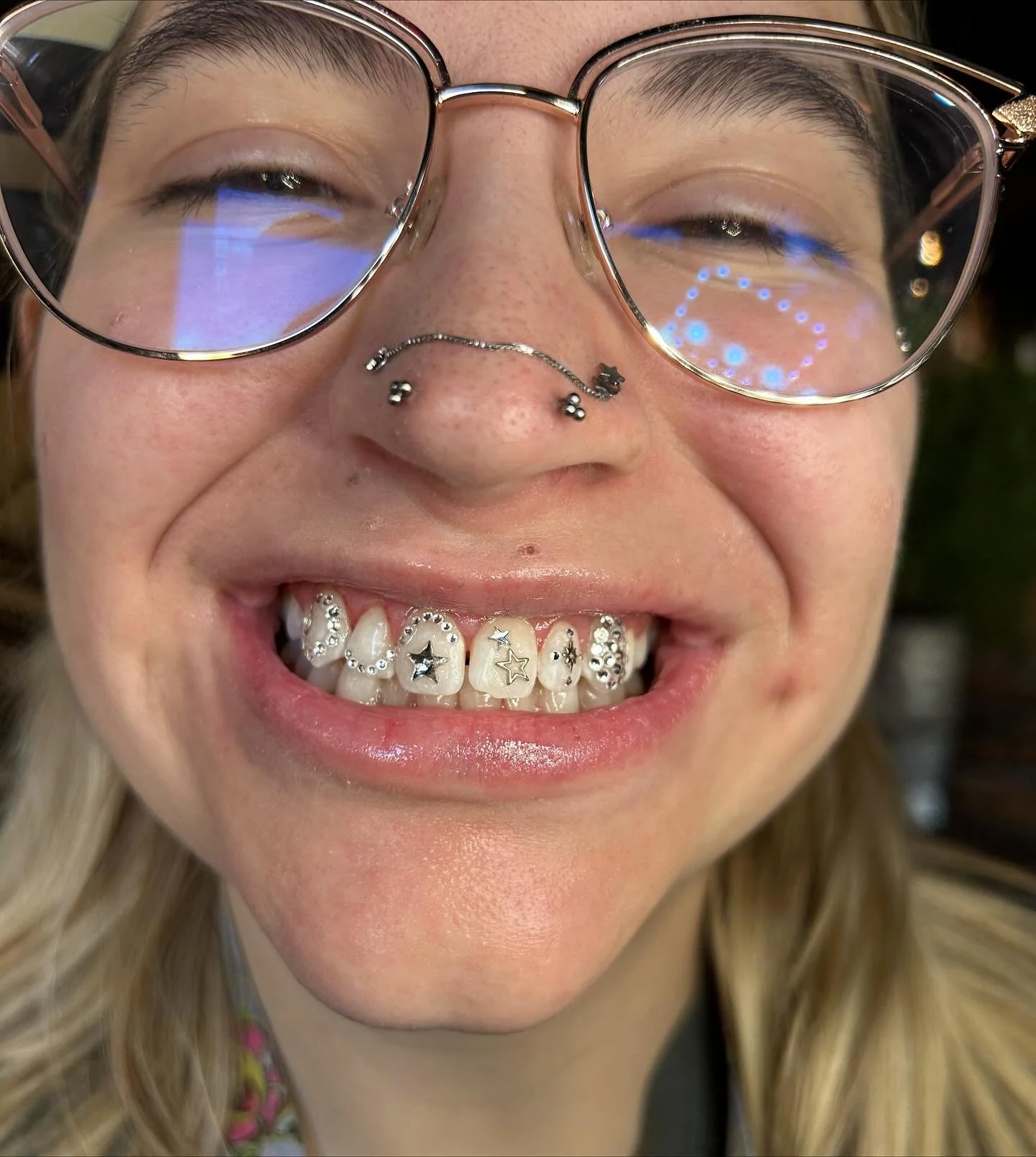 COOLEST SET EVER tysm Sophia!!!! Canines from over a year ago, sometimes you just gotta go til ur out of teeth to cover!!!! ⋆˚☆˖&deg;⋆｡&deg; ✮˖ ࣪ ⊹⋆.˚