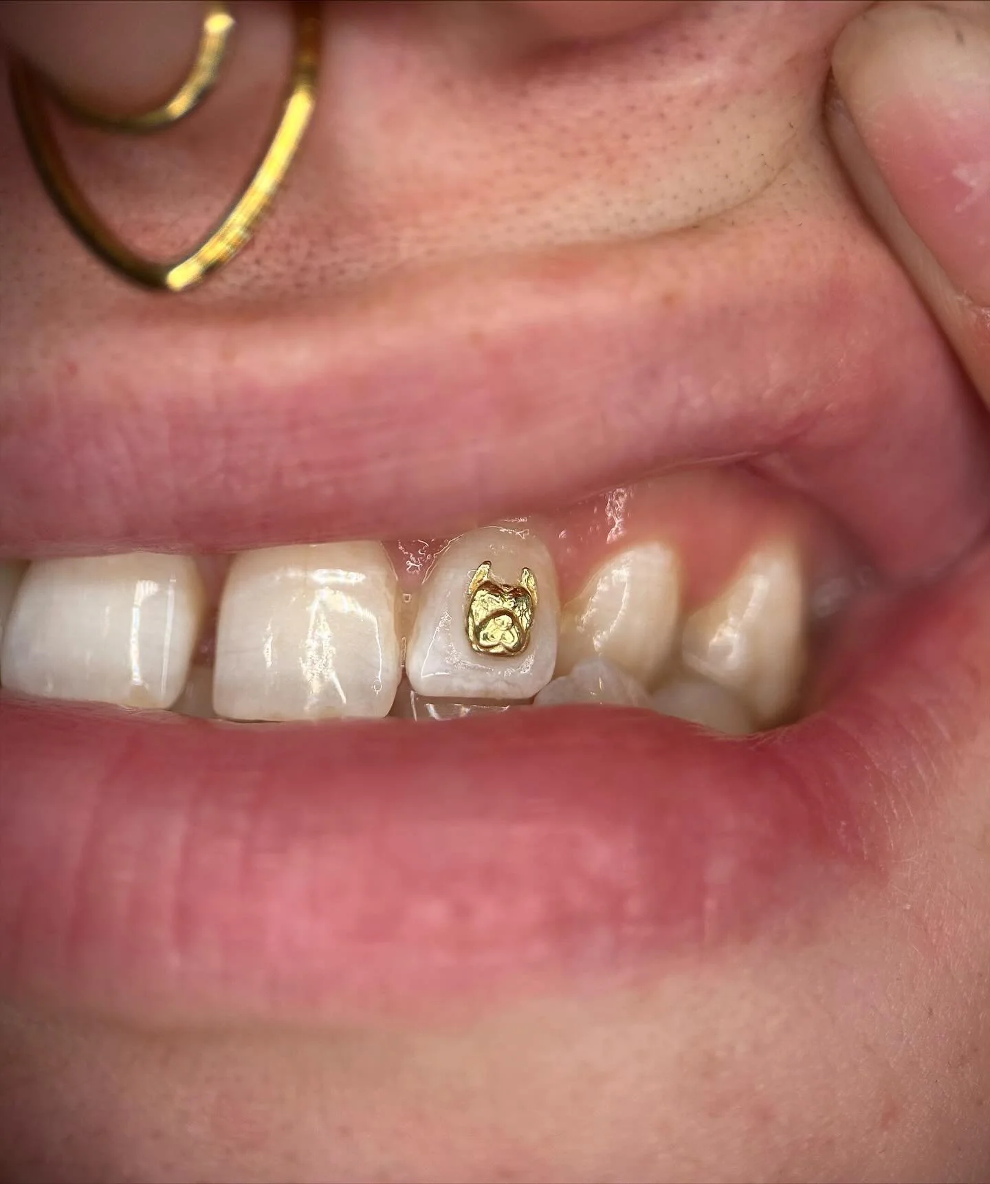 18K PITTY TOOTH GEM by @isisngold accompanied by a hollow faux cap 🐶🐾🦴 we love Ally &amp; the rest of the @rebeldogsdetroit crew, be sure to follow them &amp; donate, they are 100% donation based!!!!! Link in bio!!! Ruff ruff!!!!