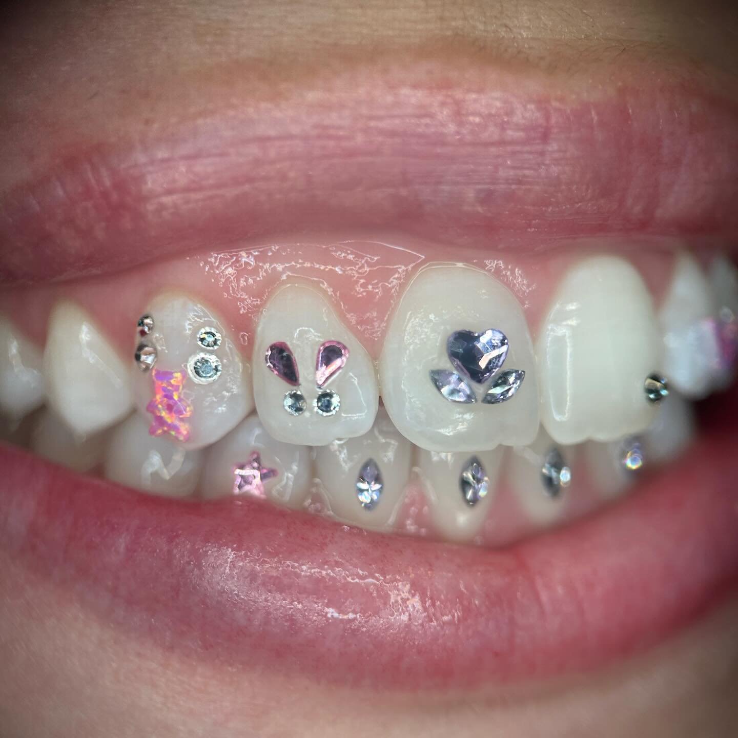 🎀₊✩💜‧₊˚౨ৎ˚₊✩‧₊🧸 thnx so much Ariana! **movie style tooth *ding* at the end**