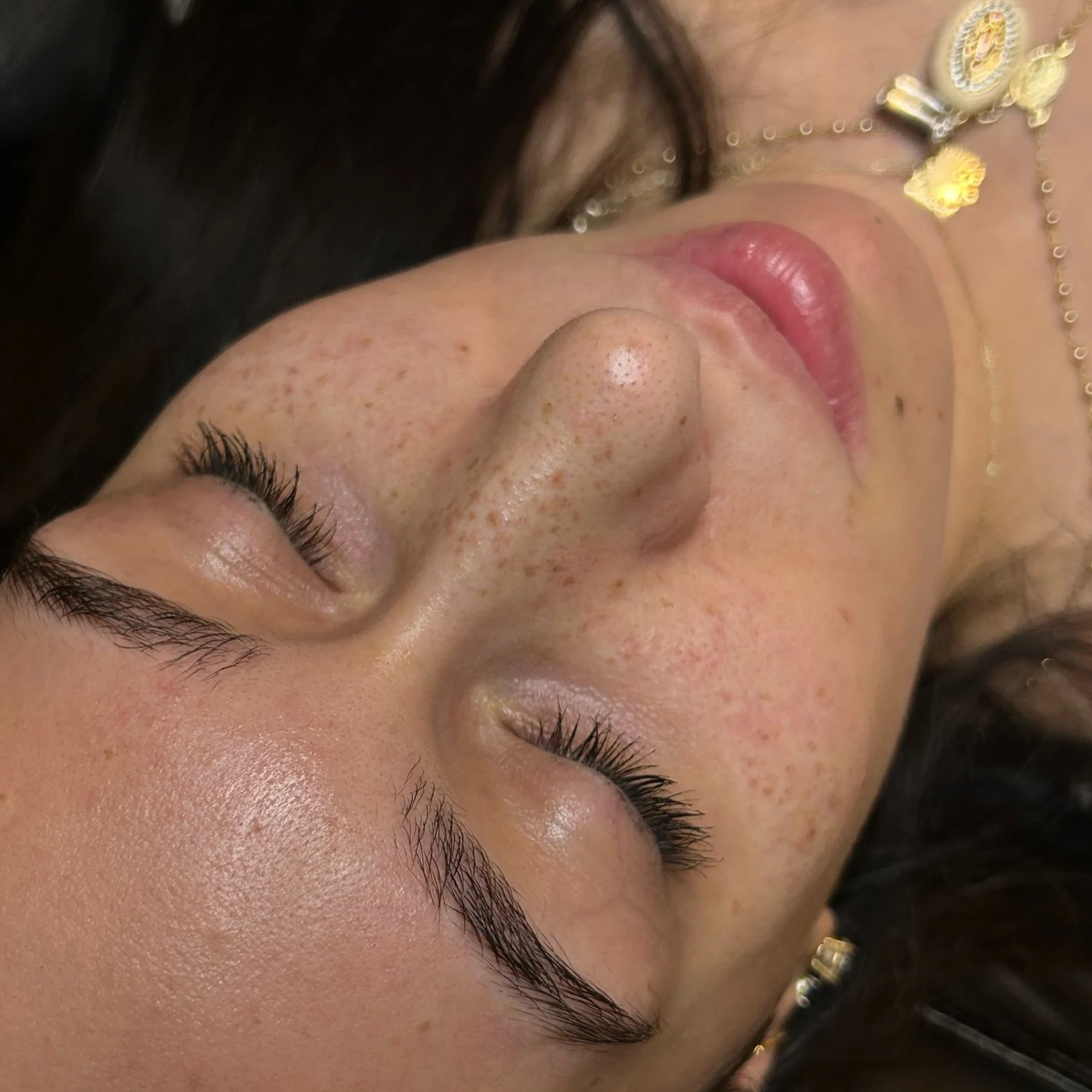 Medium Coverage Freckles