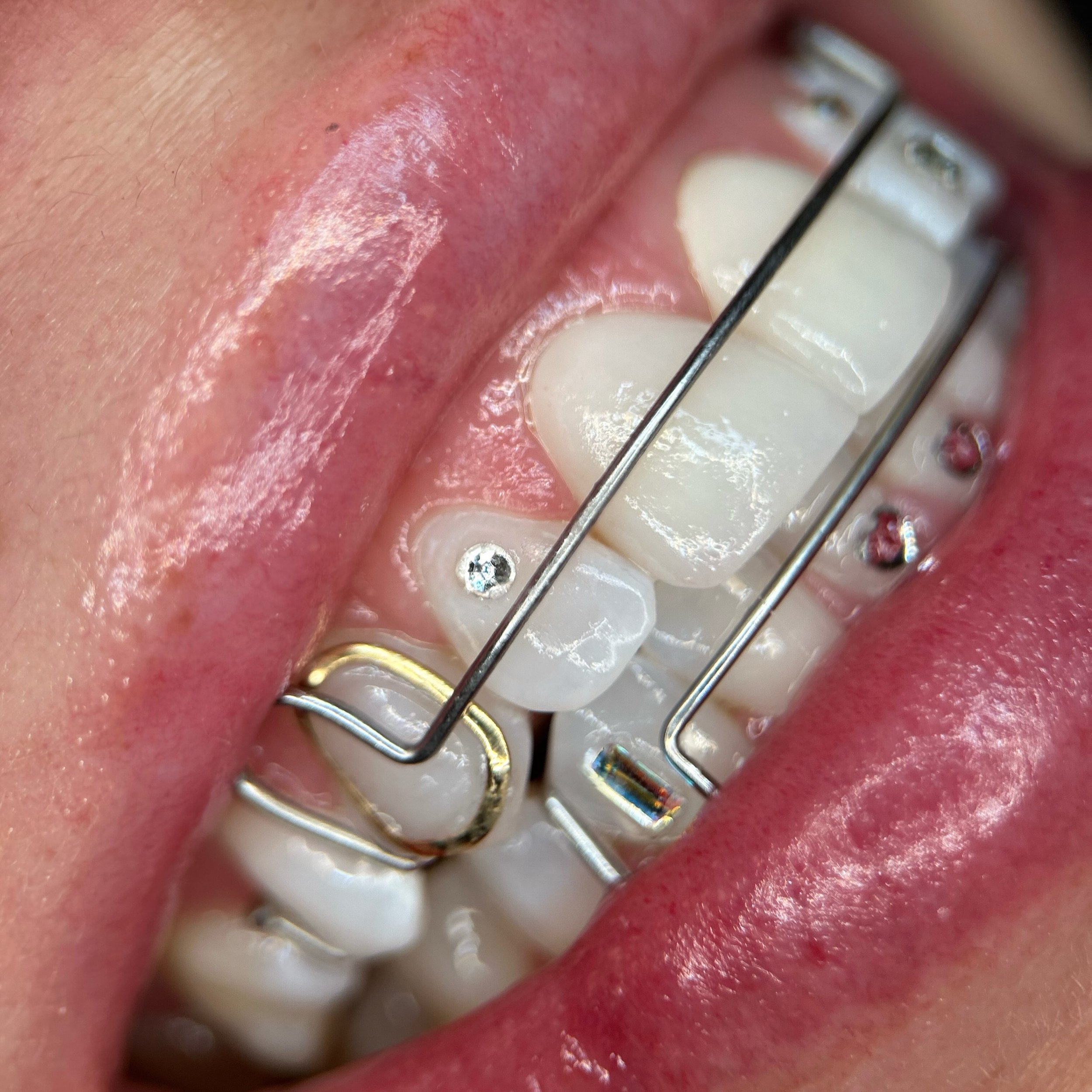 Had such a fun time today making this retainer-friendly set on my longtime beautiful and funny client Danielle!!!!!! 

2 crystals from this set are from back in 2023, the gold window was a fallen soldier reapplied easy peasy and 4 newbies were welcom