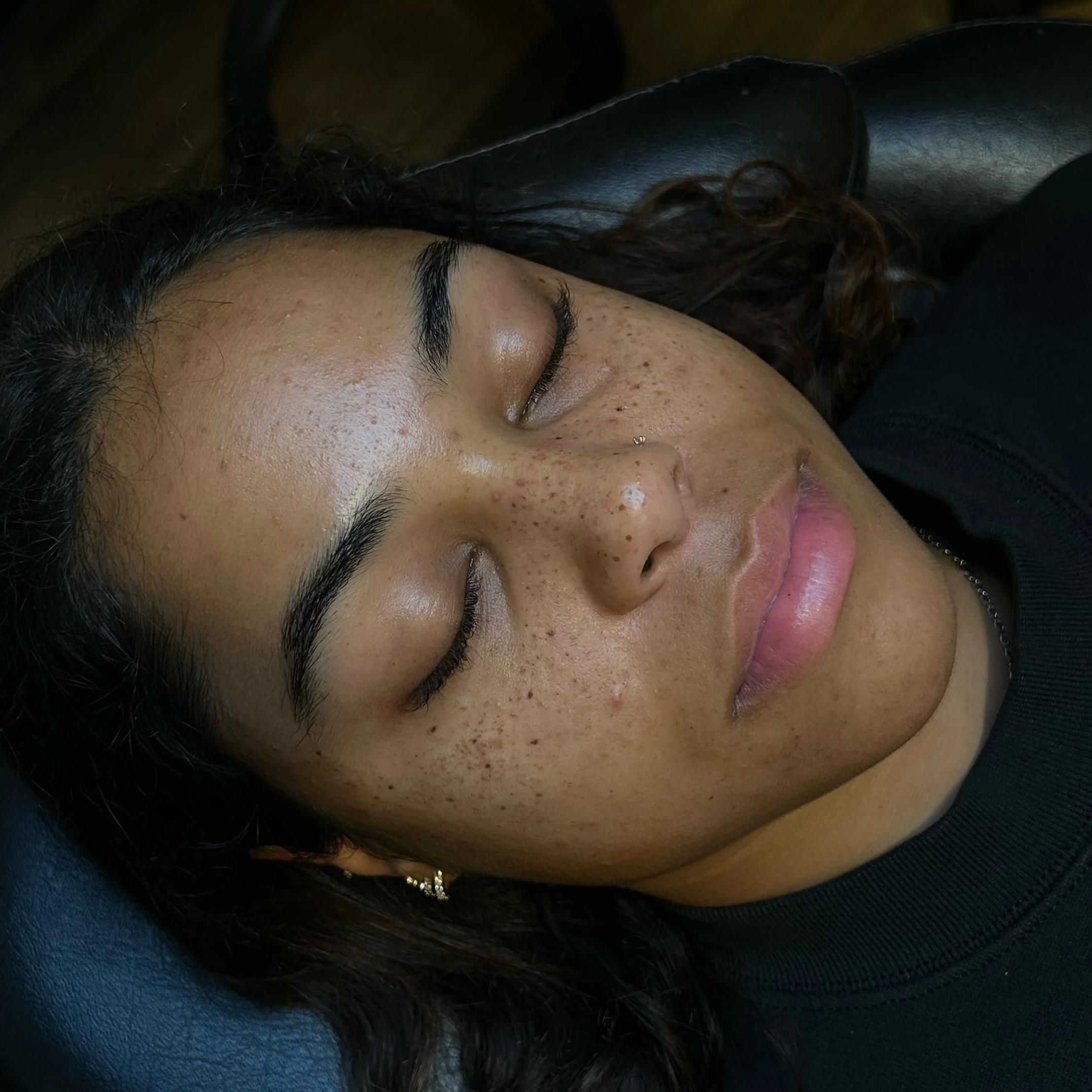 Cosmetic Tattoo Rework/Cover-Up - Freckles