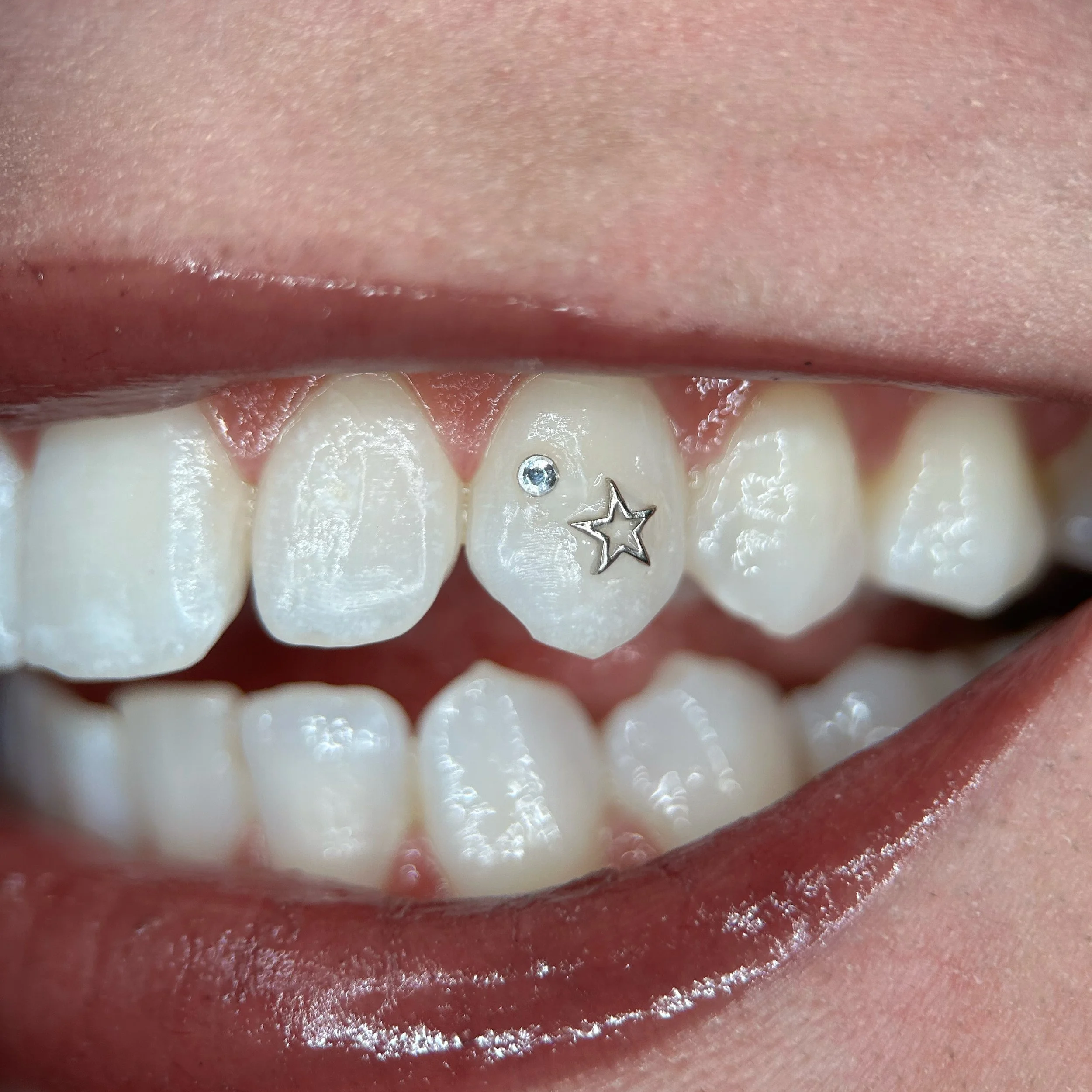 18k White Gold Tooth Gem + Crystal Tooth Gem
